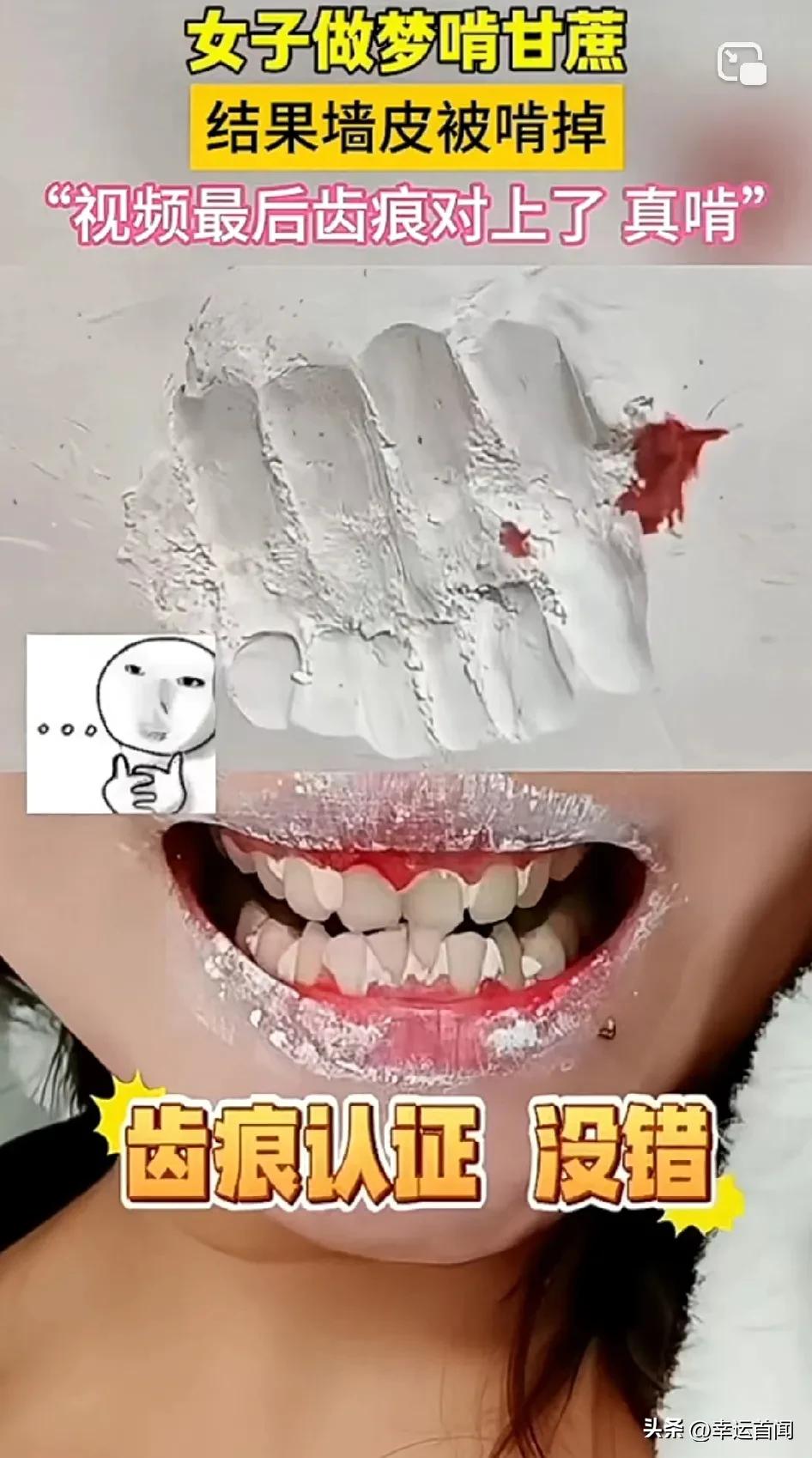 女子做梦啃甘蔗，结果真的吃上了！
醒来后发现嘴角有血，这才发现自己梦游把家里的墙