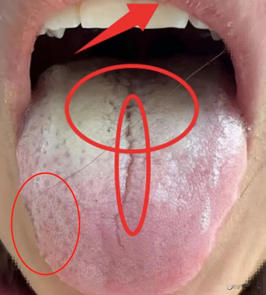 身体有热可不能盲目清，气血不足还敢除湿清热？只怕你会越除越虚啊

这是怎么回事呢