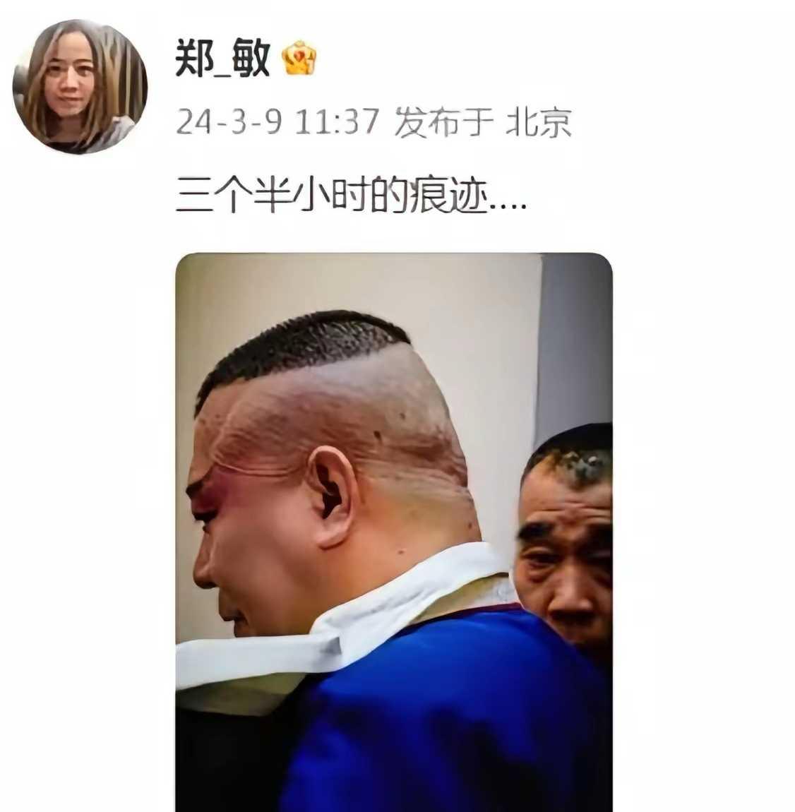 云鹏的妻子郑敏，分享了一张郭德纲的照片。那是老郭唱完戏卸妆后，头皮上留下的痕迹，