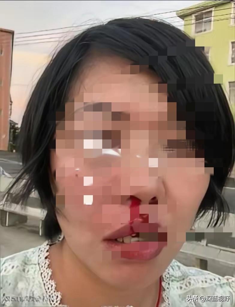 江西菜市场的“买鱼拒付款被揍”事件，算是把底层人的火气彻底点燃了。
​花钱的就是