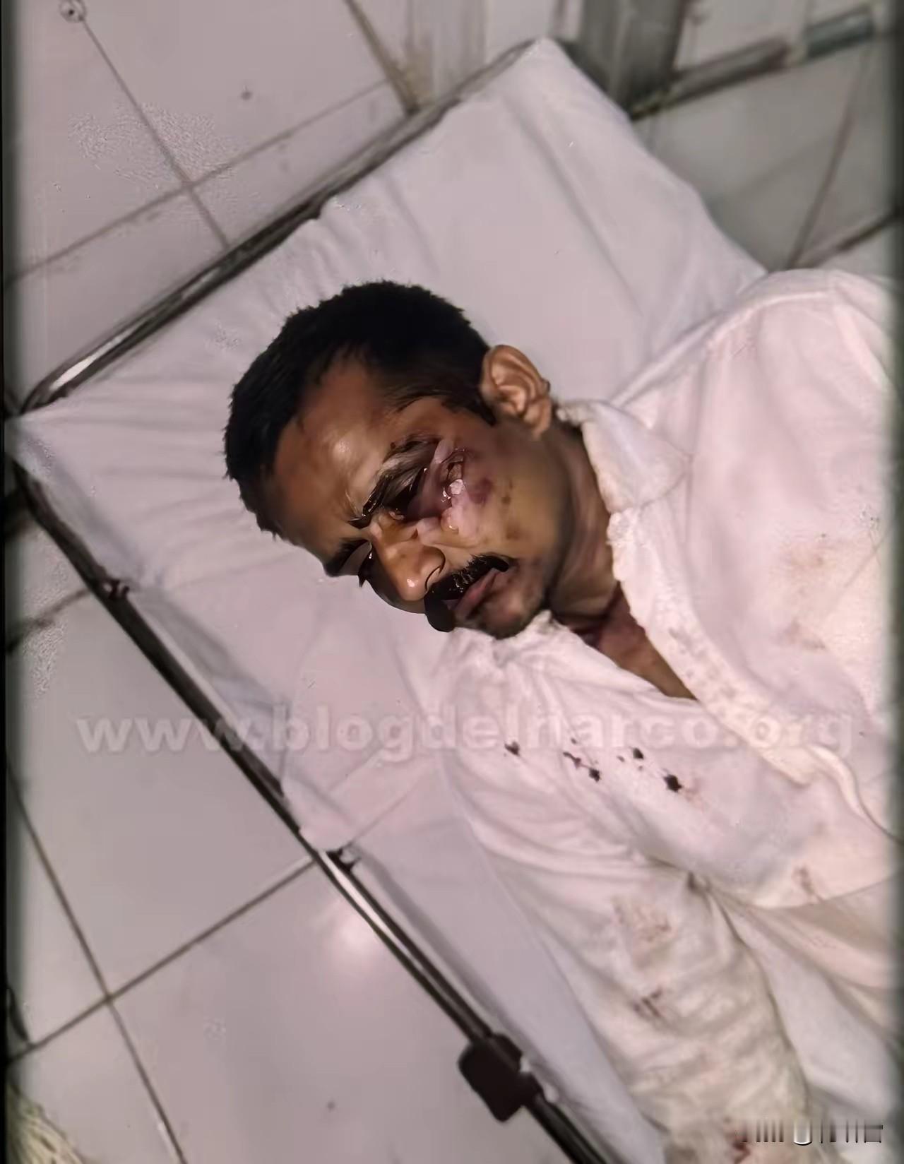 死在女人身上？一文读懂埃尔·门乔是怎么死的。埃尔·门乔躲避逮捕15年，墨西哥警方