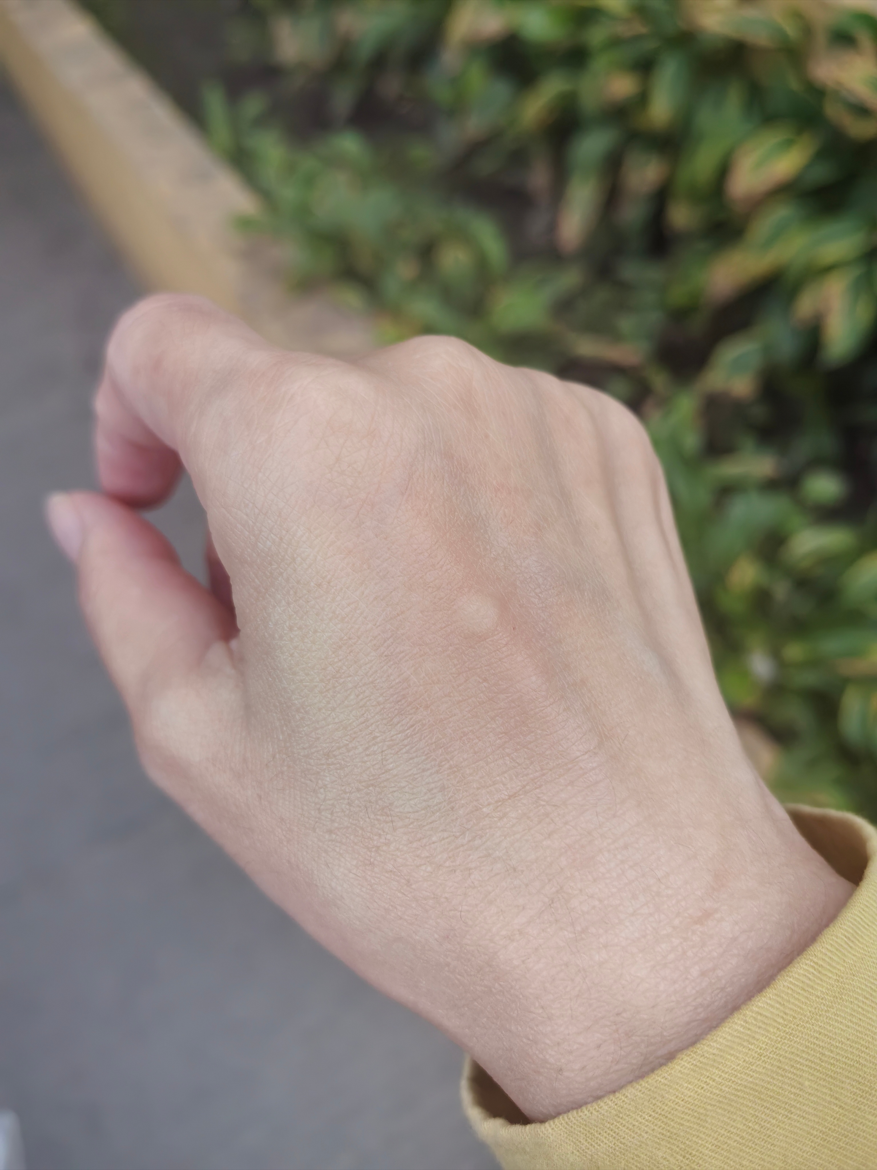 一个夏天没被蚊子咬没想到都入秋了还是没躲过 ​​​