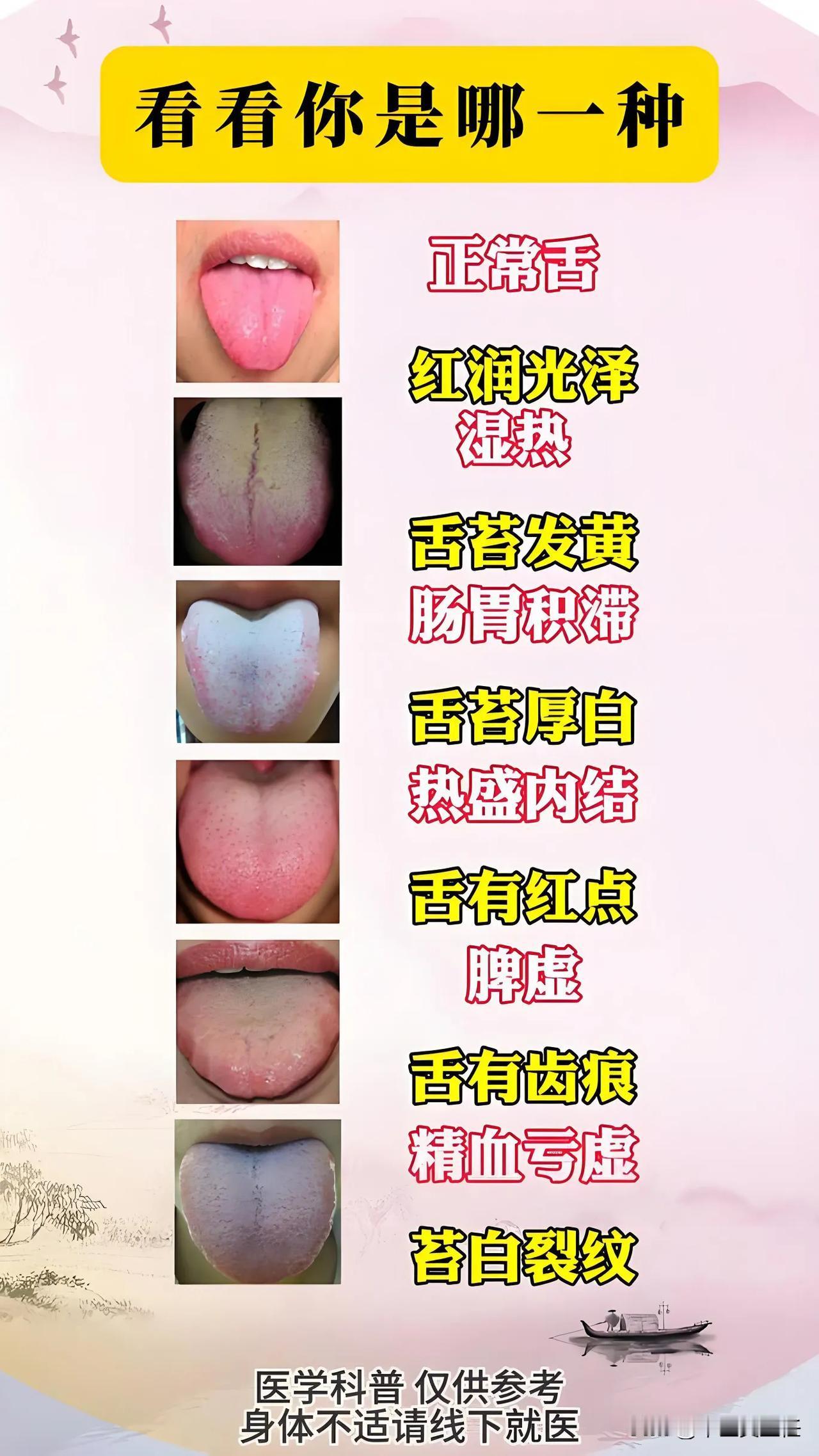 但愿世间人无病，宁可架上药生尘，6种常见舌，你是哪一种？
1.健康的舌象 ——红