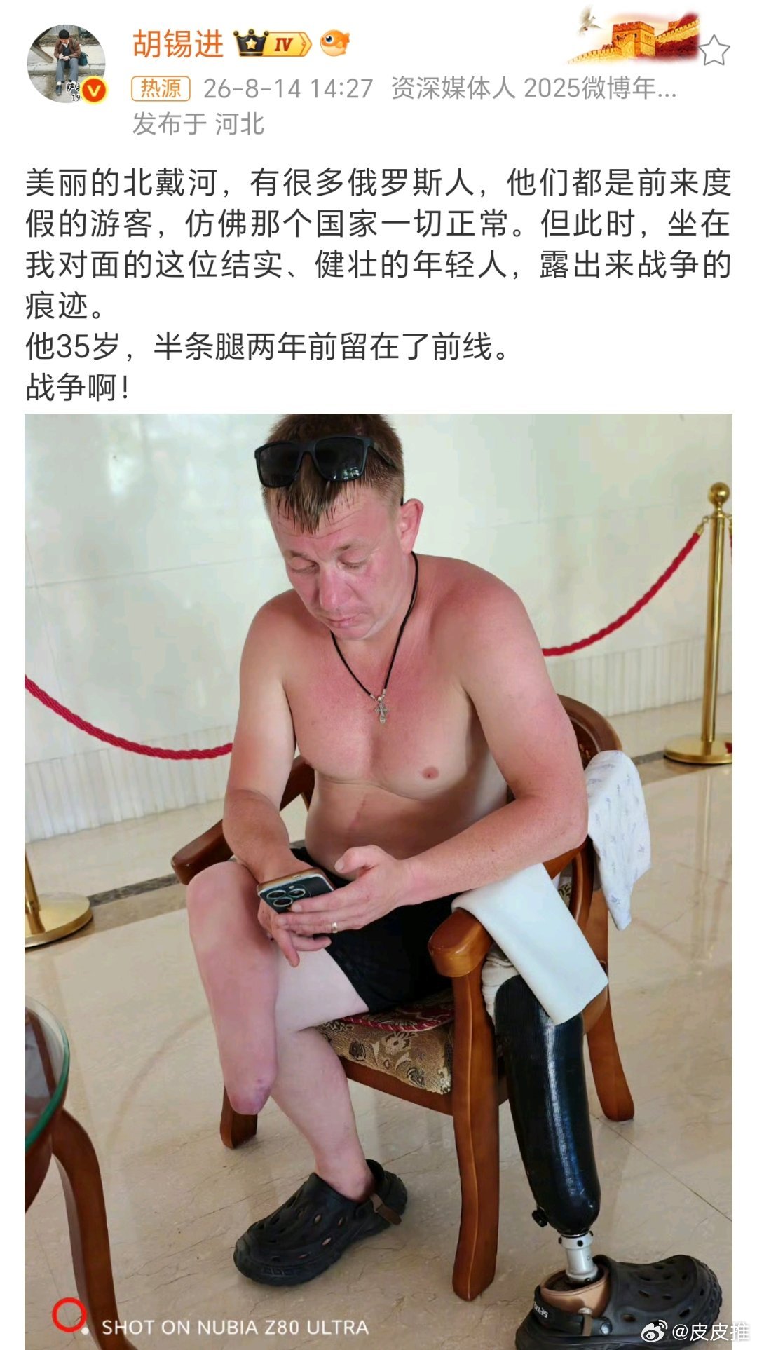 胡锡进北戴河偶遇俄罗斯伤兵老胡还是很厉害的，去北戴河度假了 
