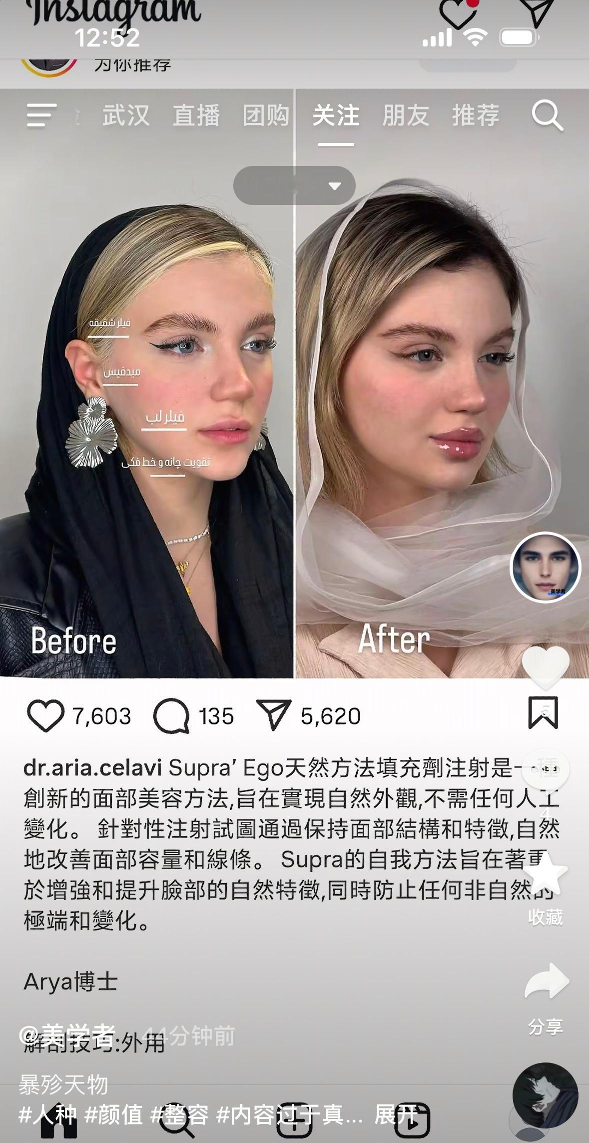 你们喜欢before还是after….在我看来这是一件艺术品被摧毁了💔🫘：美