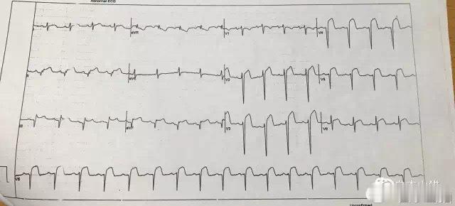 为什么自觉肩膀痛，有时候竟然会这么危险？他48岁，是个软件攻城狮。那天他吃过晚饭