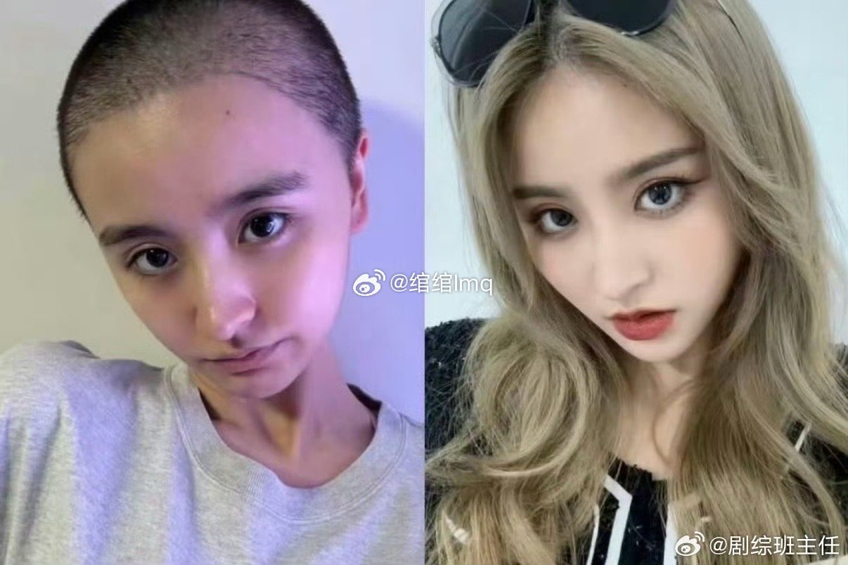 金子涵退圈之后剃寸头暴瘦金子涵退圈之后剃寸头暴瘦金子涵在退圈之后剃寸头暴瘦，还被