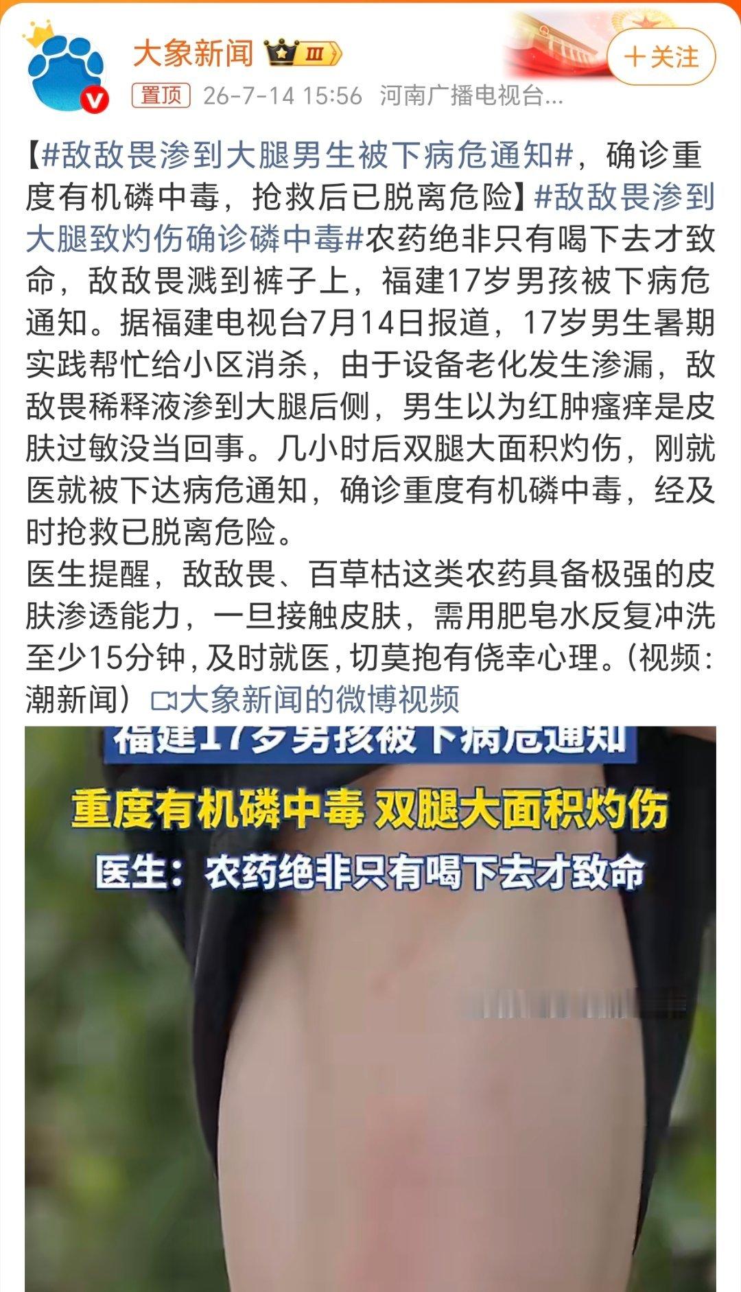 敌敌畏渗到大腿男生被下病危通知这个咋这么严重呀！之前打农药经常是用敌敌畏，它相对