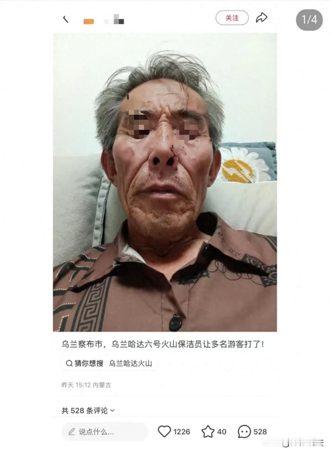 内蒙古，一68岁的保洁员因劝阻游客不要乱扔烟雾棒，竟遭多人围殴，对方不仅用烟雾棒