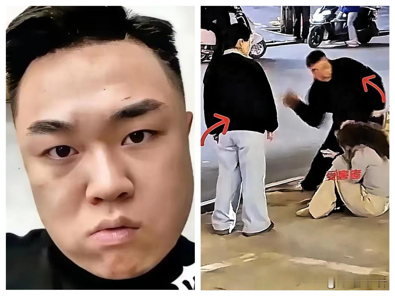 慌了，彻底坐不住了。
听说打人那一家子人，这两天四处在托人
到处找关系，想求情、