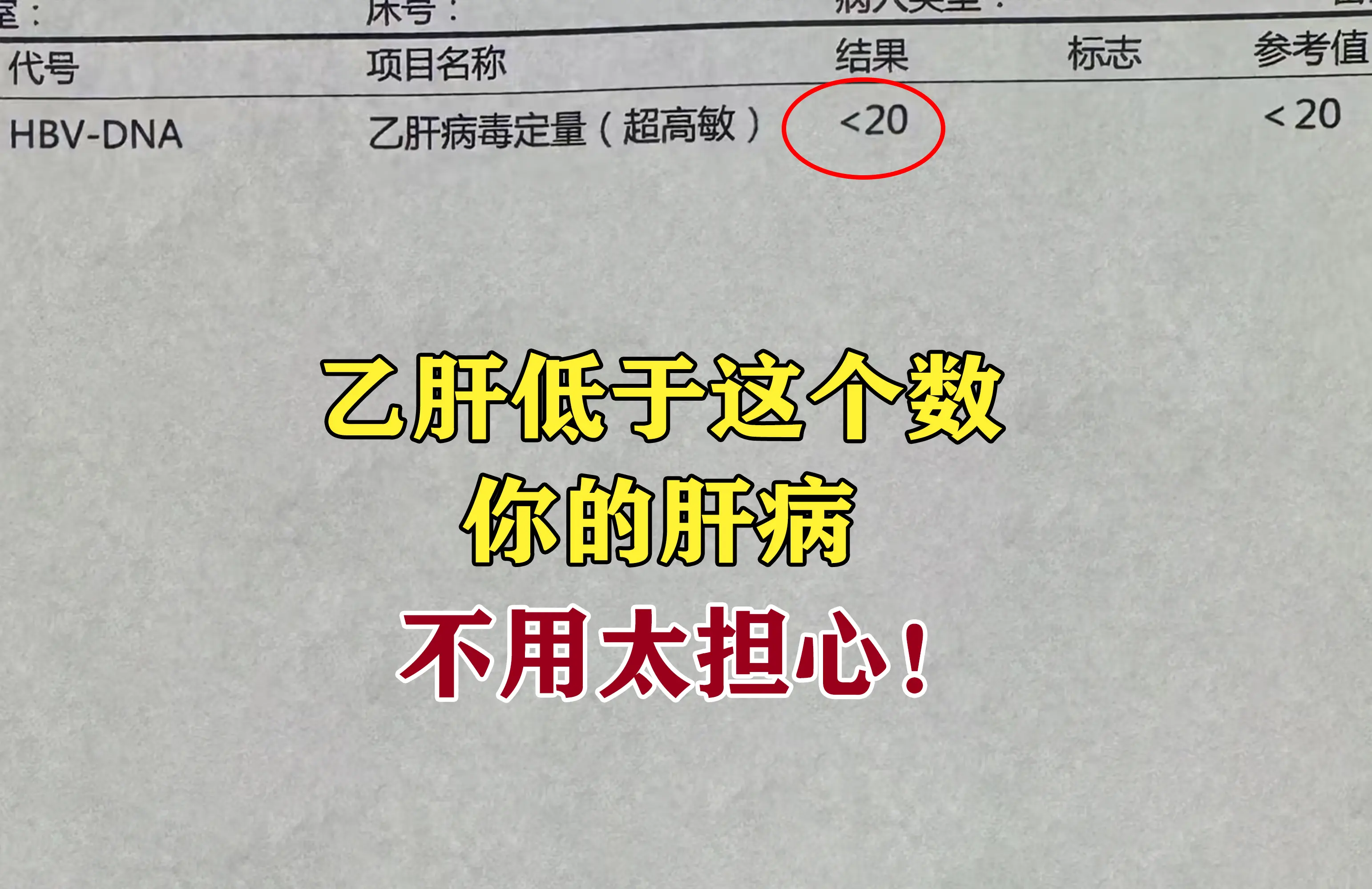 和肝病打交道40来年了，乙肝患者最关心的问题，莫过于病毒量到底降到多少...