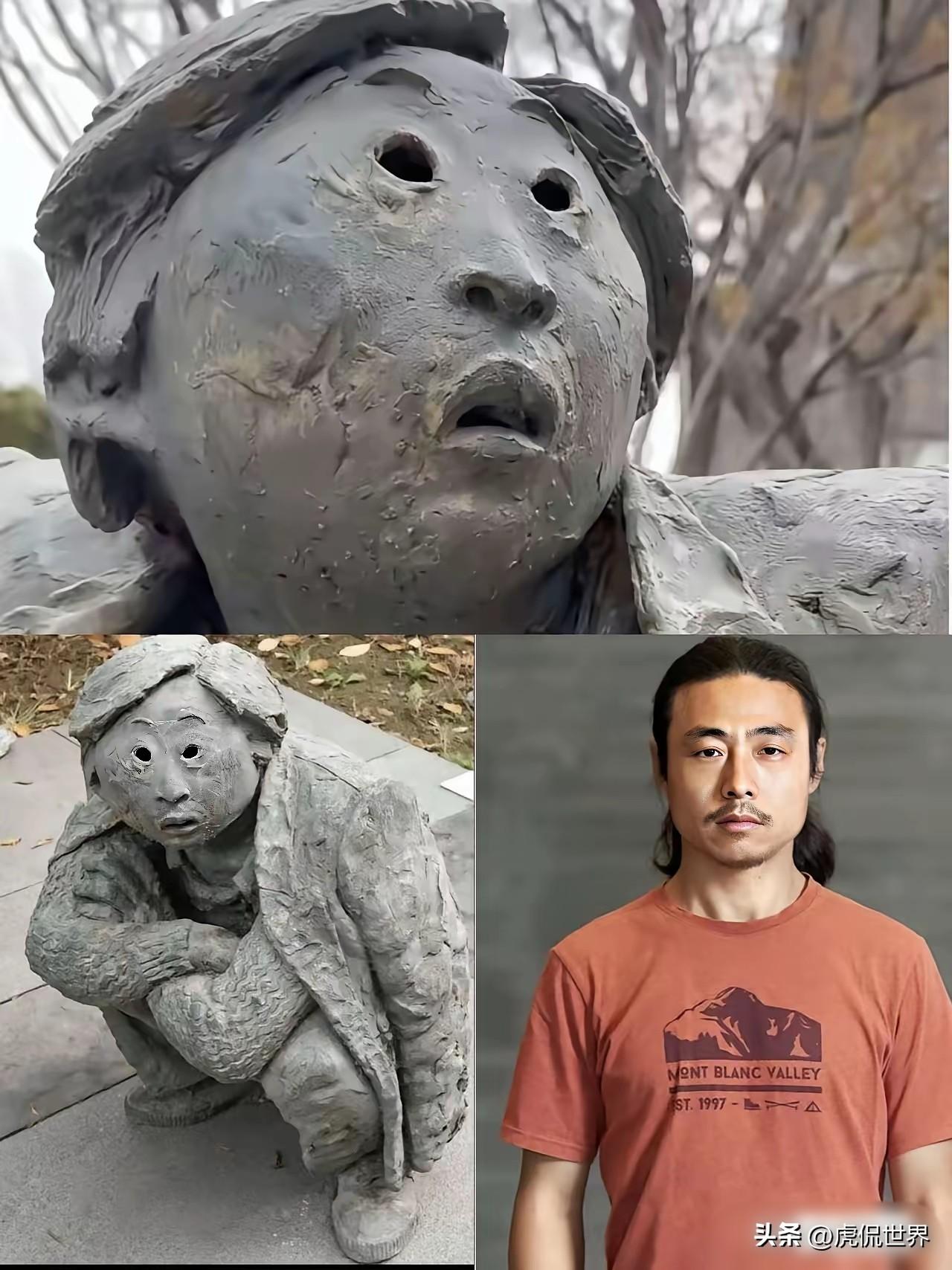 眼距宽、眼裂小、外眼角上斜，鼻根低平、鼻梁塌，目光呆滞，这是非常典型的愚型儿。