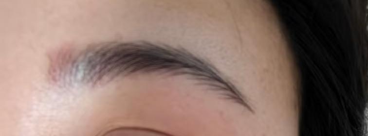 今年做的最后悔的一件事，本来想美美的过年，结果被麻药烫伤了
敷麻到昨晚将近两个小