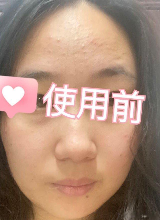 第一次用[娇韵诗光芒小瓷瓶]，因为之前也用过别的美白产品，但是相比较而言娇韵诗的
