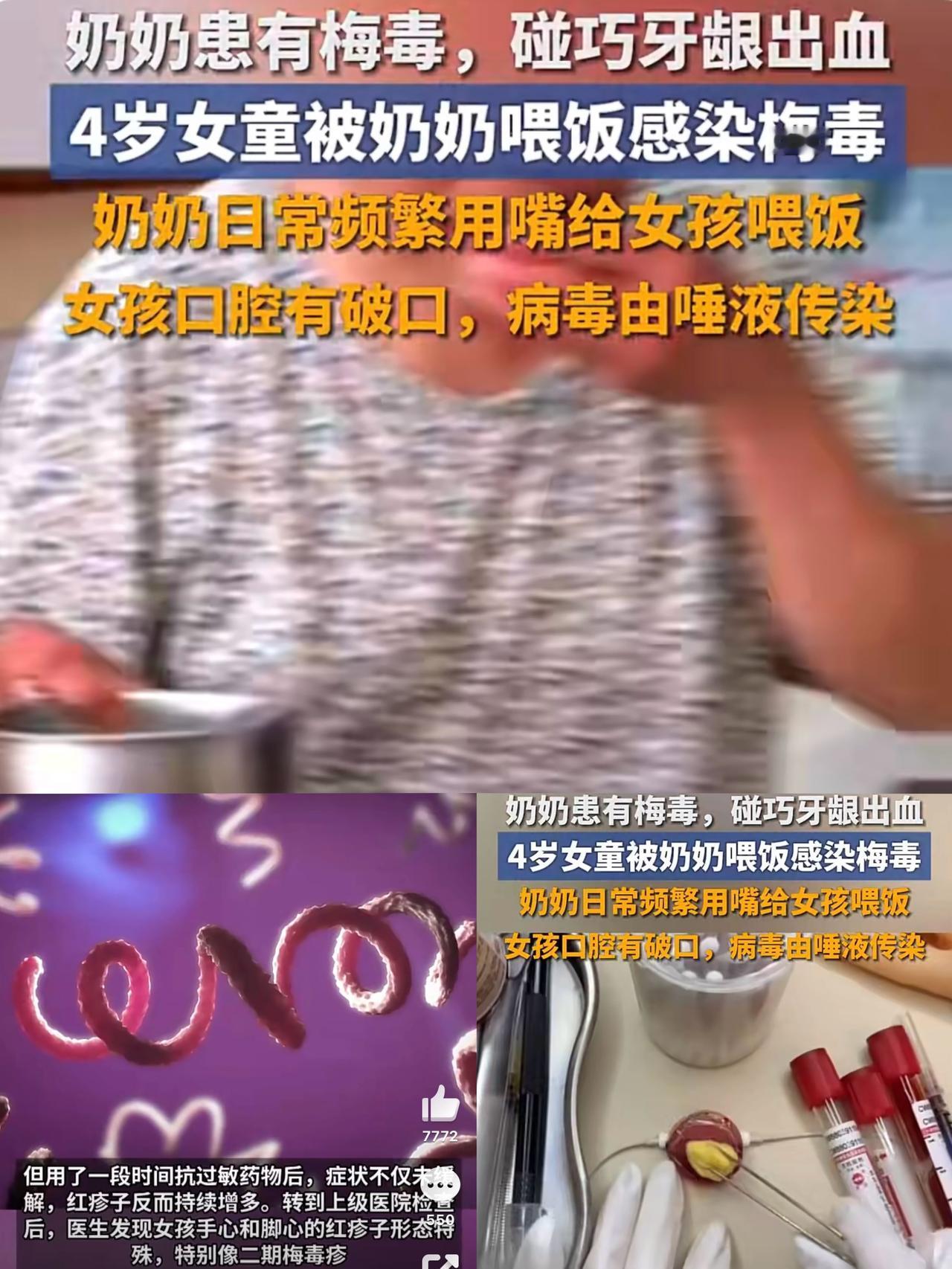 万万没想到啊，这个年代了，还对小朋友用嘴喂饭？安徽一名4岁女童被奶奶用嘴喂饭从而