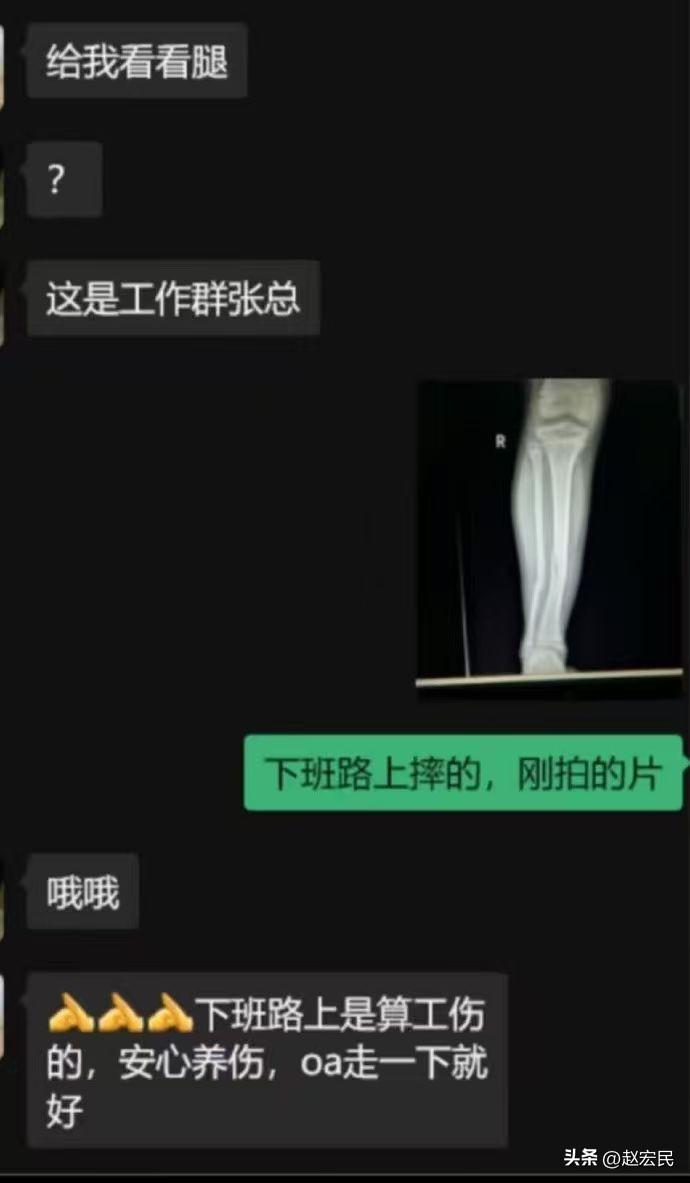 老板突然在工作群里说——给我看看腿。
你会如何回复？？ ​​​#员工高情商回答#