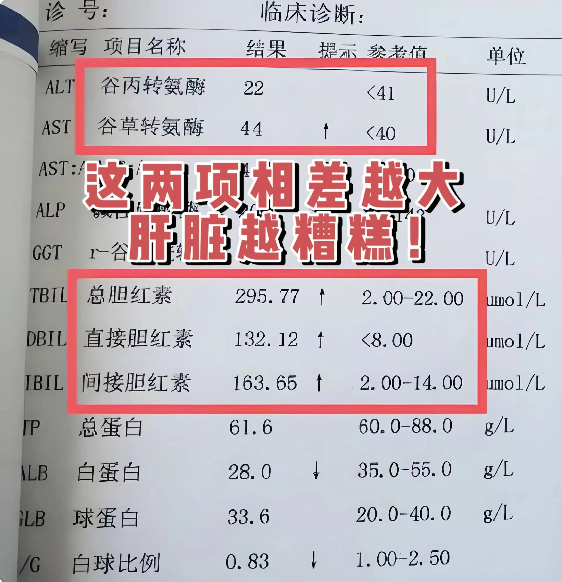 对于肝病患者而言，在拿到肝功能化验单时，有两项指标需重点关注，一是转氨...