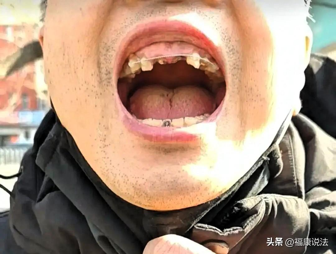 辽宁沈阳，男子清晨6点，穿过停车场换乘，却被高出地面20厘米的电缆盒绊倒，磕断3