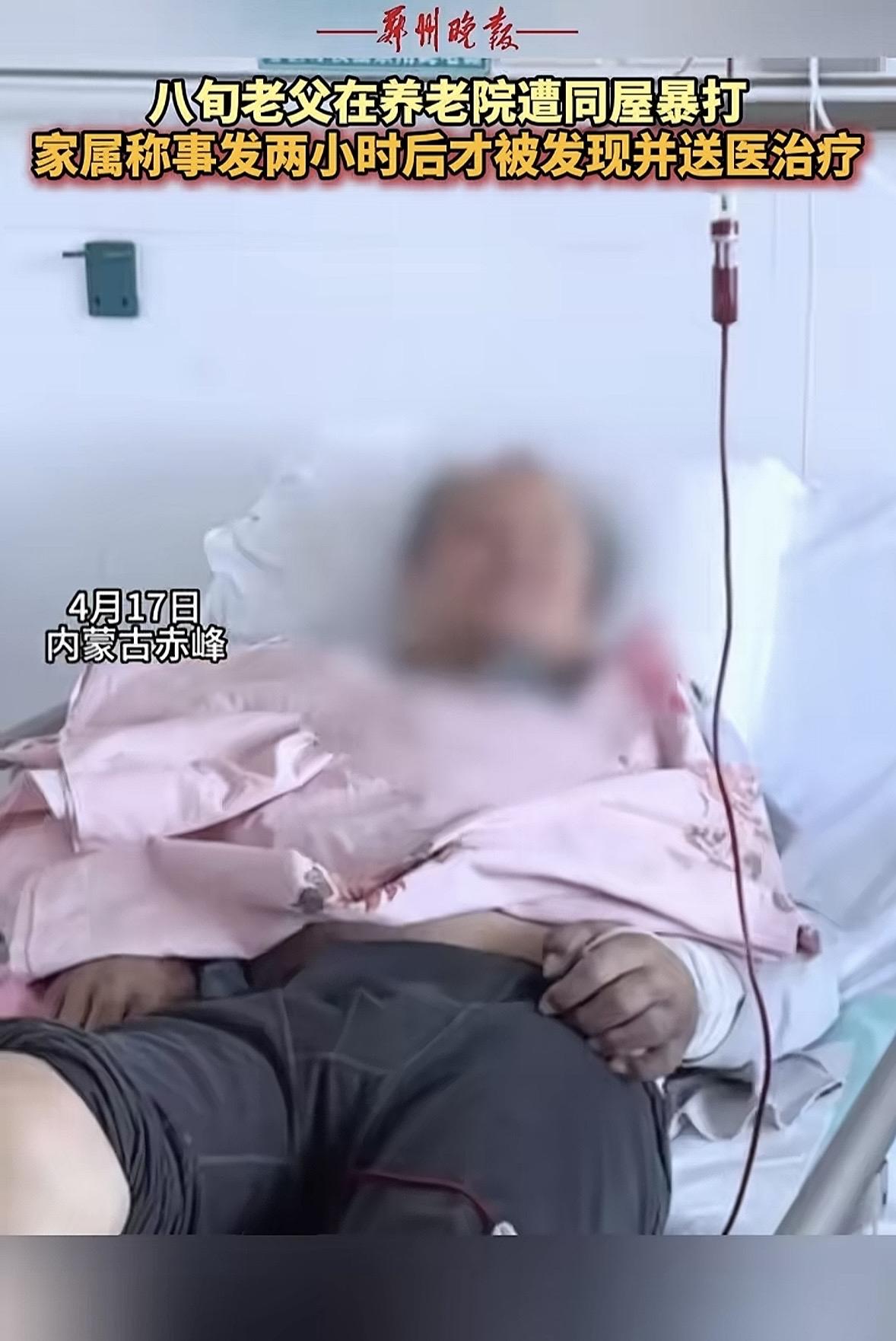 内蒙古赤峰，男子接到消息，自己年过八旬的老父亲在养老院被同屋老人打了，对方拿着木