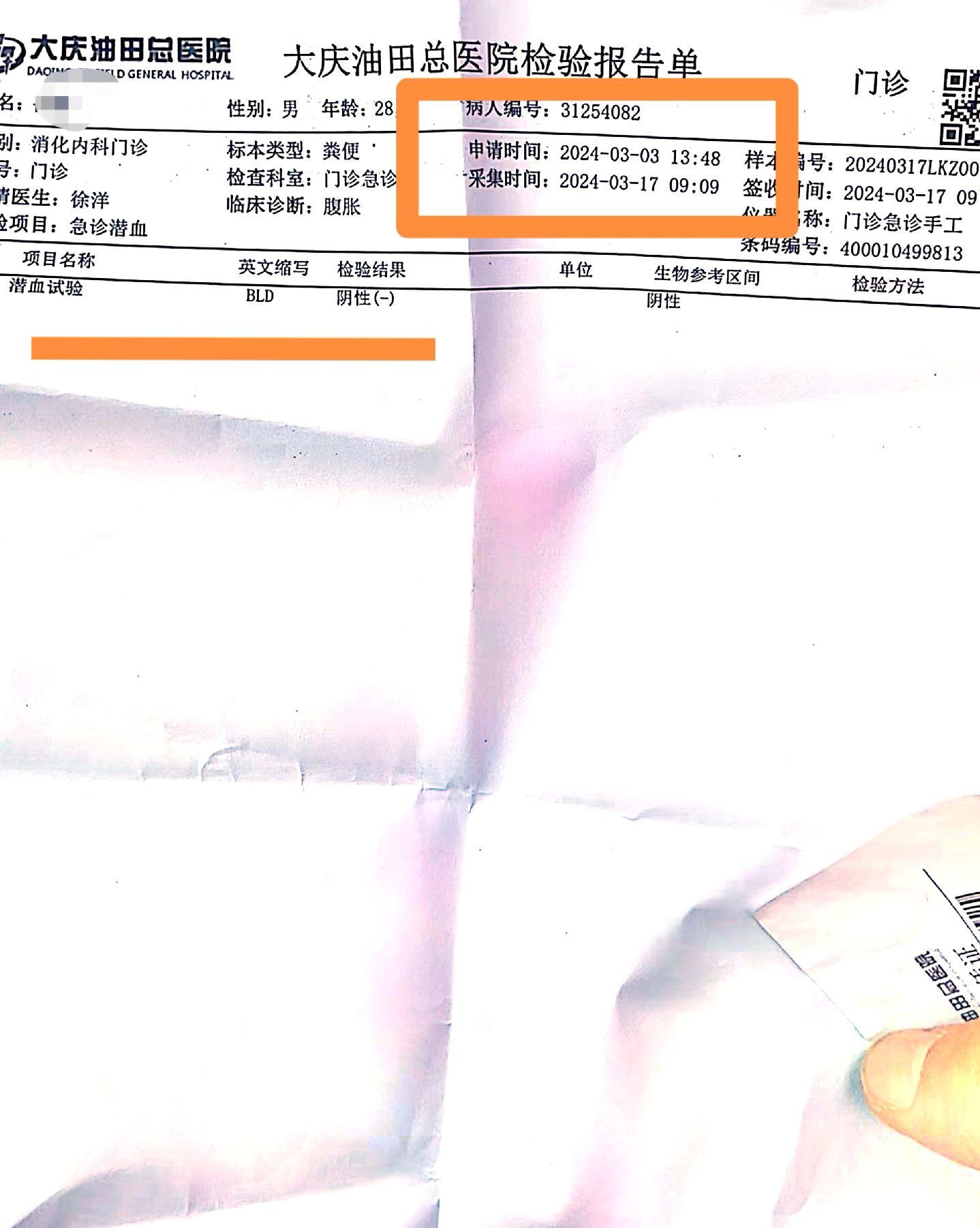 粪便隐血阴性到肠镜黏膜愈合是递进关系。
哈尔滨的溃疡性结肠炎老病人，年轻小伙子，这次自信满满，觉得可以肠镜100分。
3月，5月测了两次粪便都是阴性，很开心，我也替他高兴。
但是我也和他说了，粪便隐血阴性到肠镜正常的吻合度在85%左右。
为什么这么说，因为你测粪便，是随机抽样，当你肠道只有范围很小，病变很轻的时候，你粪便中的血，就会很少，以至于可能测不出来，不像之前很严重的状态，一测都是阳性。
所以两者是递进关系。当然我也宽慰他，已经比21年发病好很