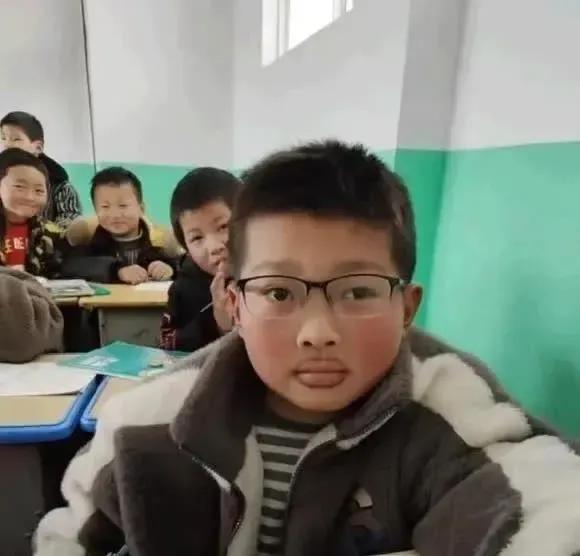 一开始我以为长胡子了。