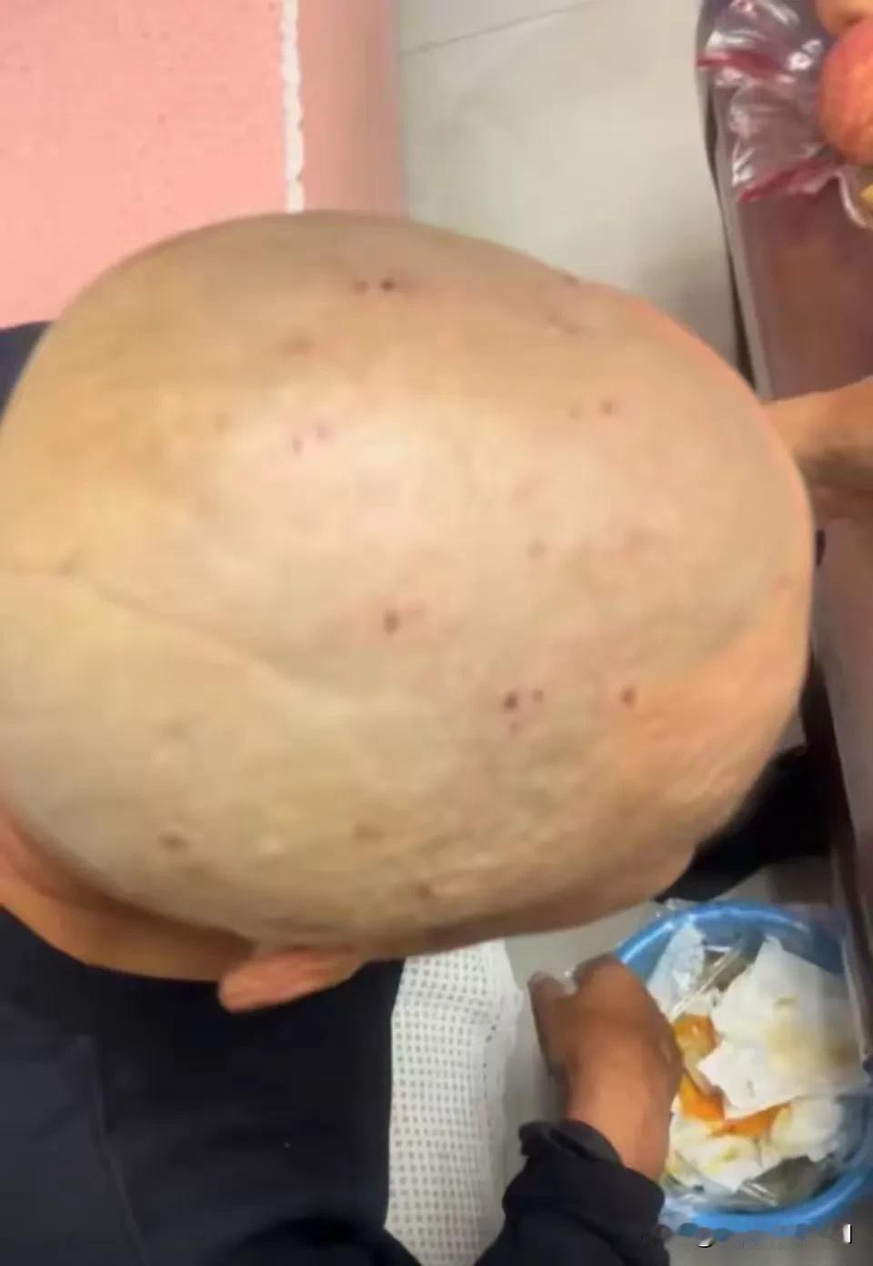 天津icon，大爷花10元剃头，结果被剃得满头伤口！女儿看不下去了，想为父亲讨个