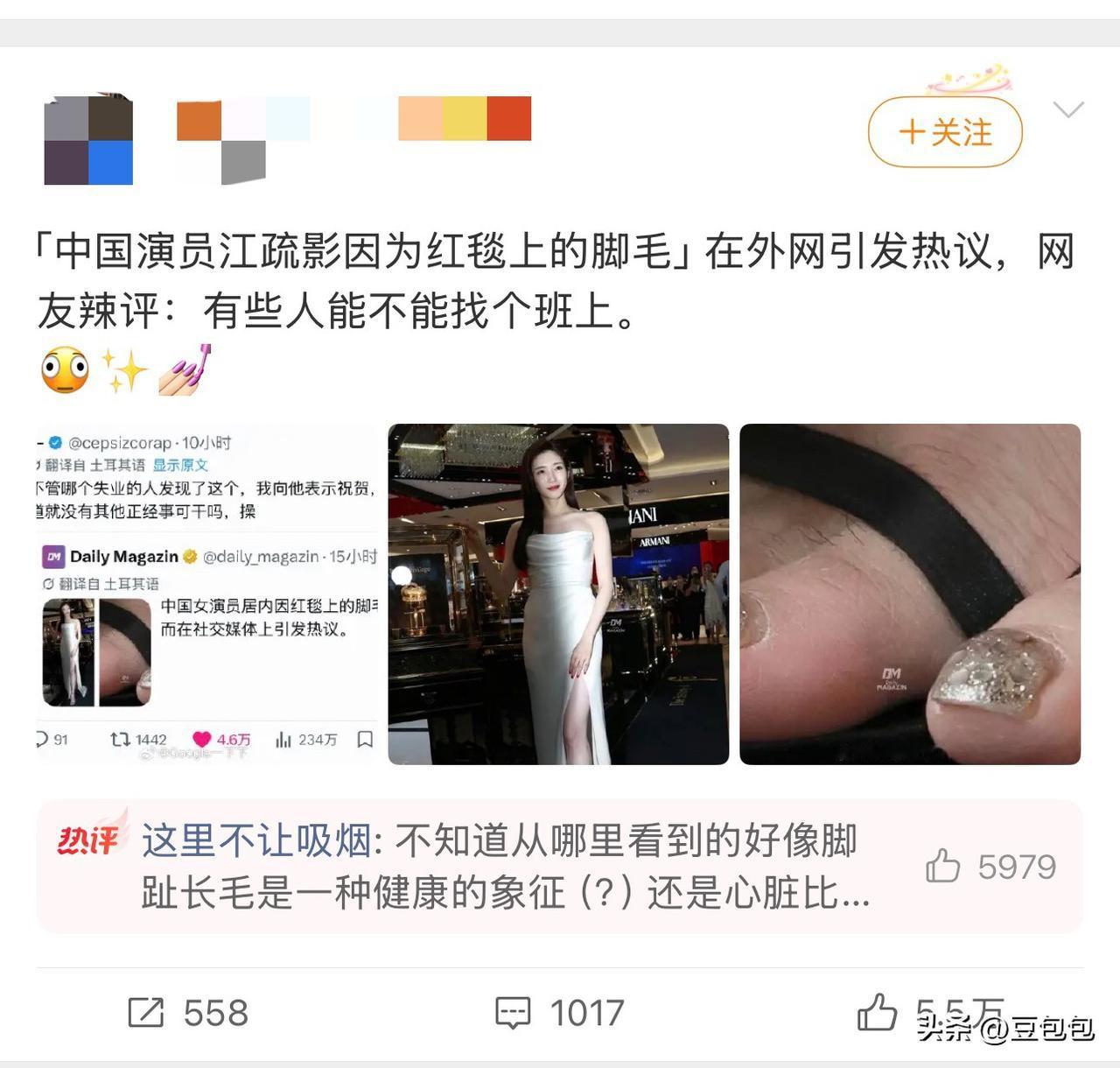 江疏影可能做梦都想不到，自己会因为红毯照上露出的脚趾有几根汗毛，而被推上热搜。