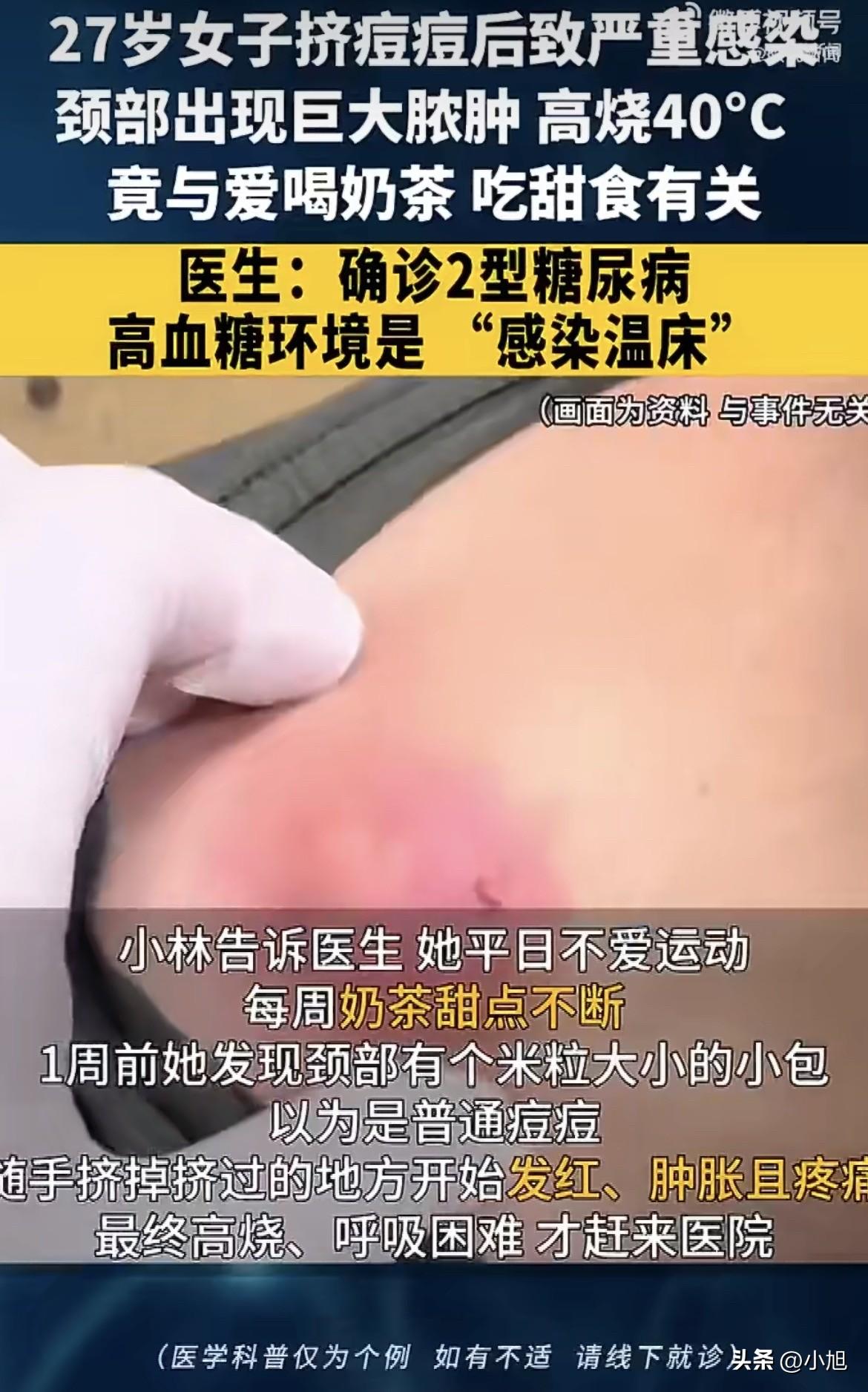 2月14号，深圳龙华区人民医院急诊科进来一个姑娘。别人都捧着花约会去了，她一个人