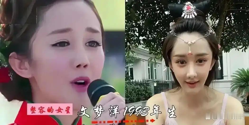 内娱这串整容翻车名单里，张檬和高溜最扎眼，脸还没老，人先被医美磨没了 