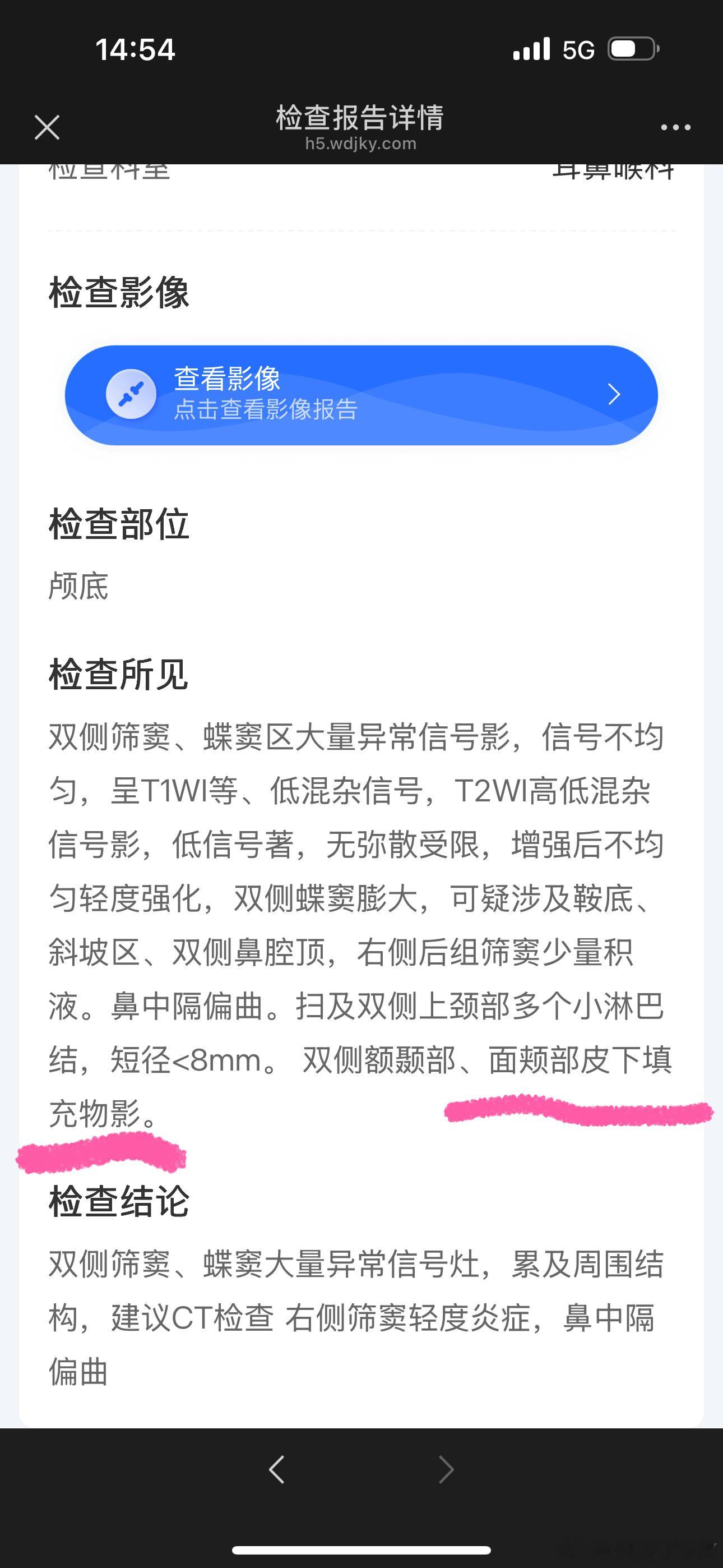 翻到之前手术的核磁共振一直皱着眉头看 看到最后一句我都要笑了我滴玻尿酸也要上榜哈