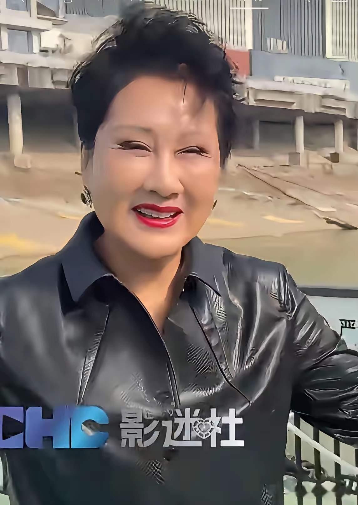 近日，张凯丽一组照片引发讨论，照片中的她眼睛似乎难以睁开，面部变化明显，连熟悉她