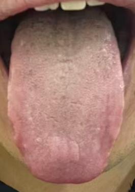 宗筋偏弱、耐受度不足，多因气血亏虚，该如何调养？






很多年轻粉丝一旦遇