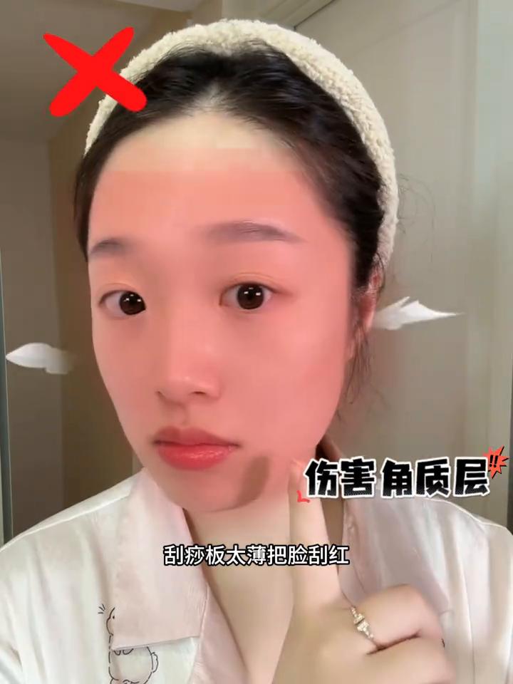 第40天：如果你和我一样出现了泪沟、法令纹、苹果肌下垂，一周一次的面部刮痧是真的