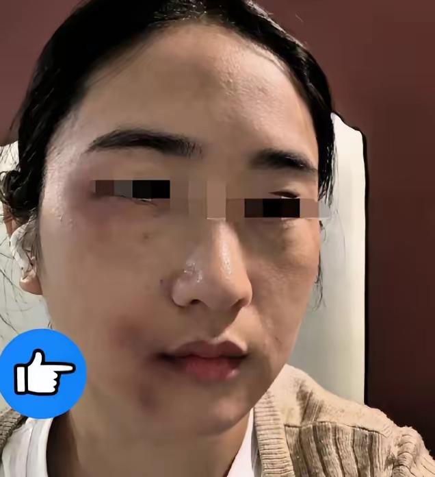 丈夫酒后动手殴打妻子，小舅子上门报复致轻伤二级，结局让人唏嘘
不少网友看完这件事