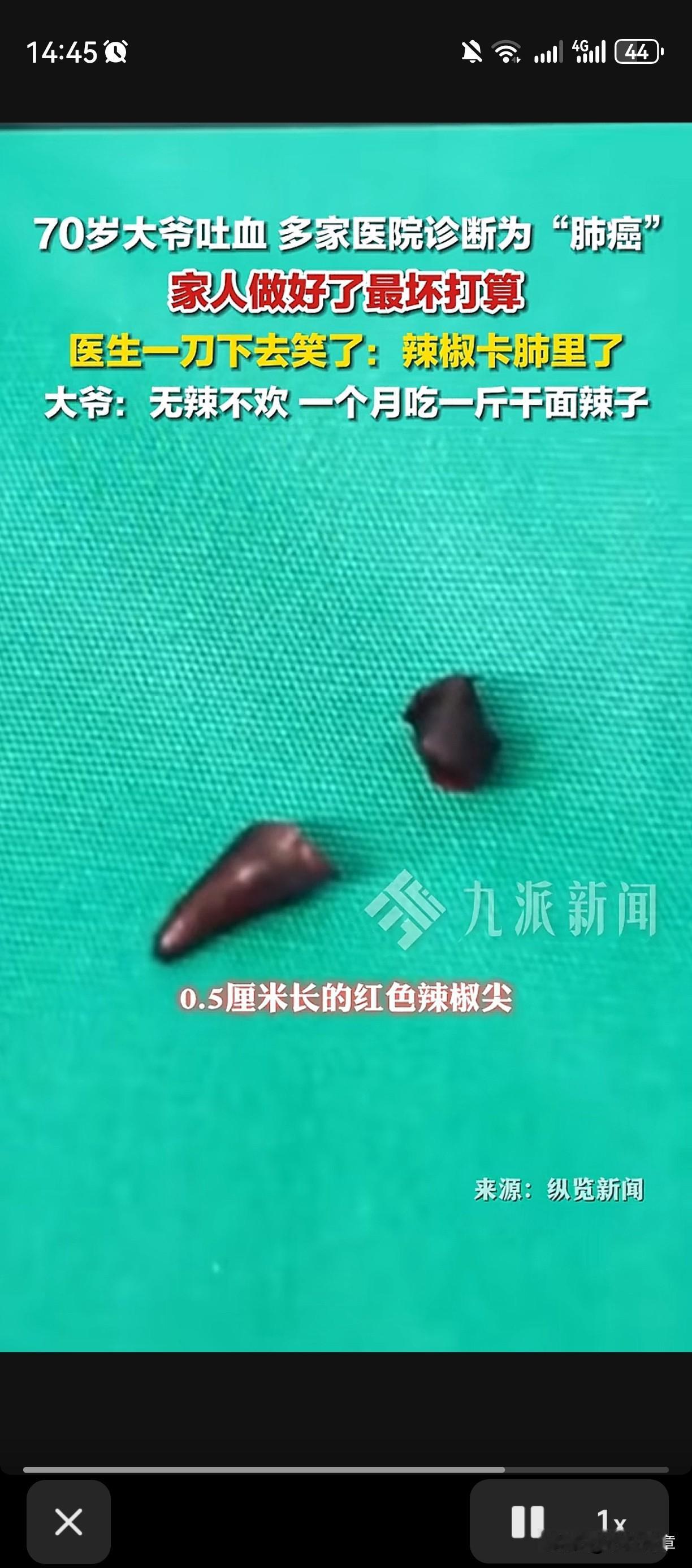 “虚惊一场”

近日，西安一位70岁的张大爷突然吐血了，去医院一检查，人家医生说