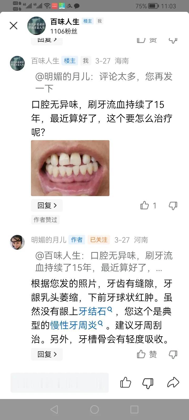 万幸在头条遇到了靠谱医生，这几年在县级市人民医院洗过三次牙，不知道是他们不懂还是