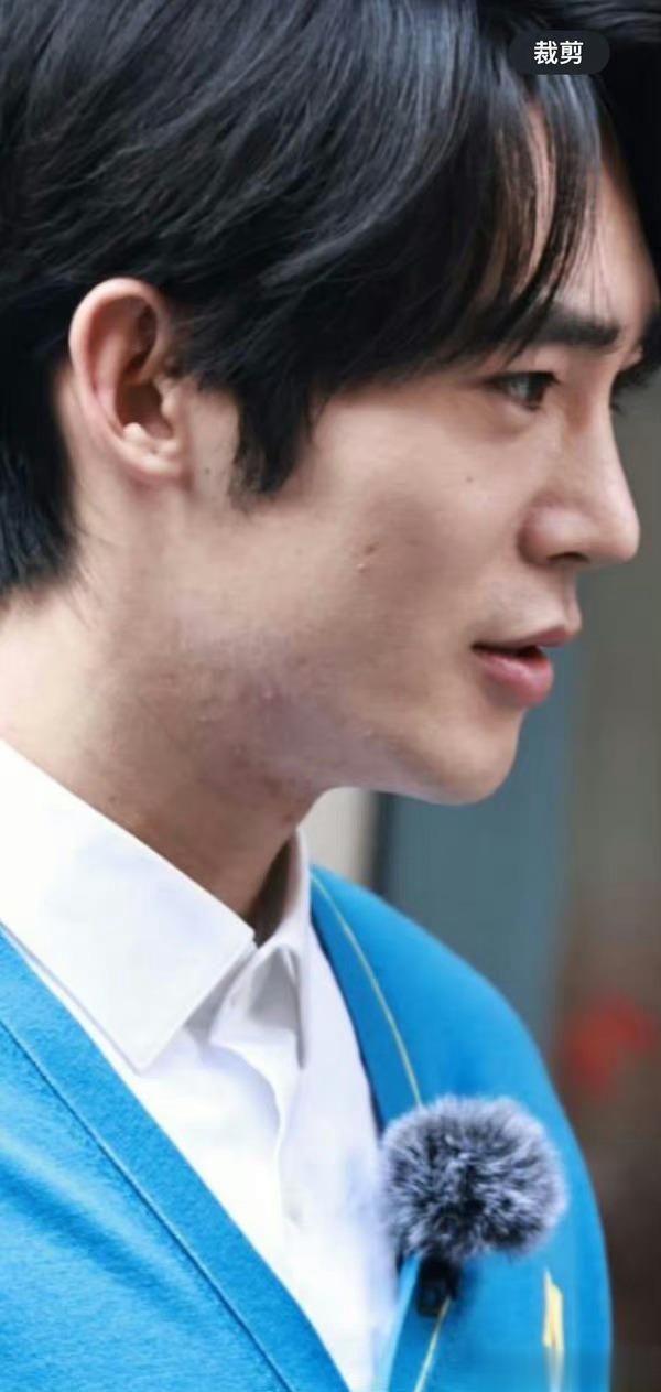 这是在反炒吗？于适这皮肤状态还不好啊[费解]#于适站姐脱粉后发的生图# ​​​