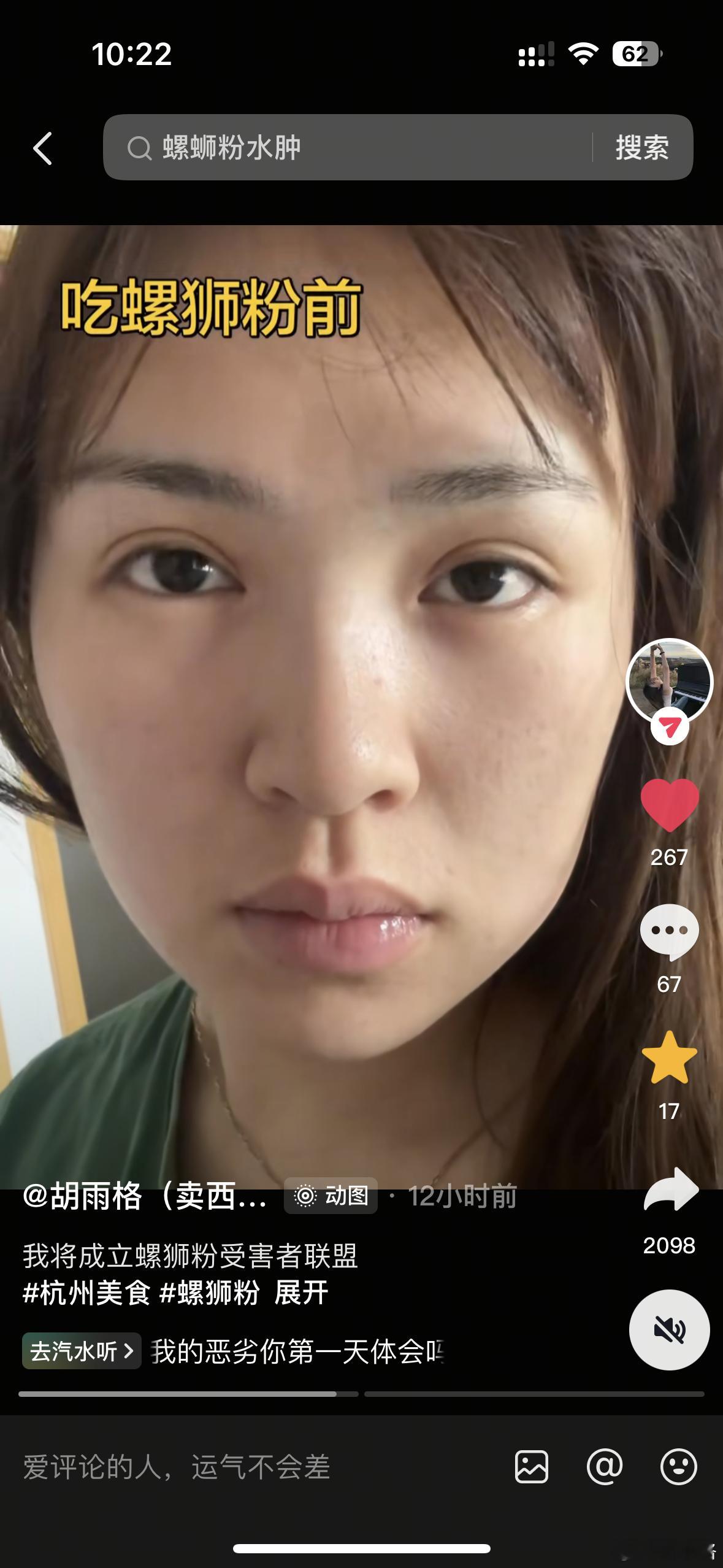 吃个螺狮粉吃肿了被20多万人看了，2000多人蛐蛐哈哈哈哈哈哈哈哈哈哈哈哈哈哈哈