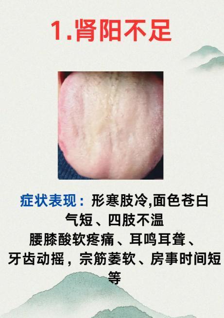 舌为身体之镜，出现这 3 种表现，多是肾虚信号