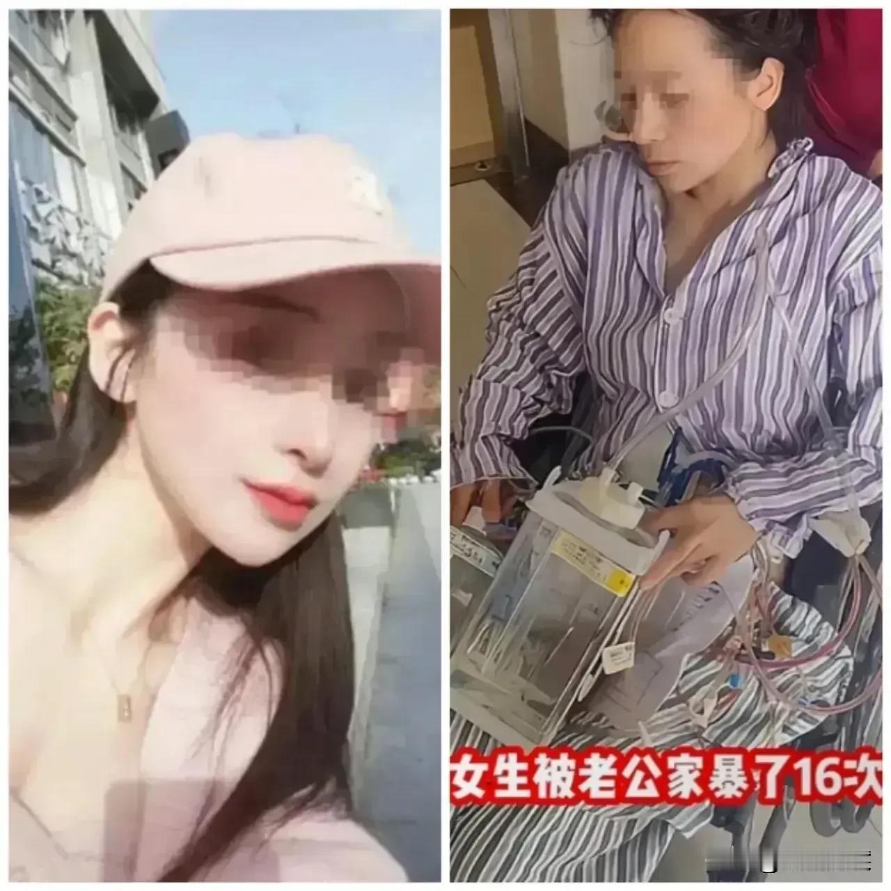 有人说，如今大街上摔倒一个人都不敢扶，揍别人一拳都要赔偿好几万，没想到一个家暴，