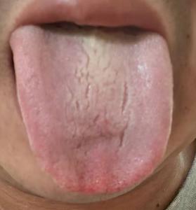 阳气弱、心火上浮，宗筋鼓动无力如何调养







一位粉丝倾诉，因早年长期耗