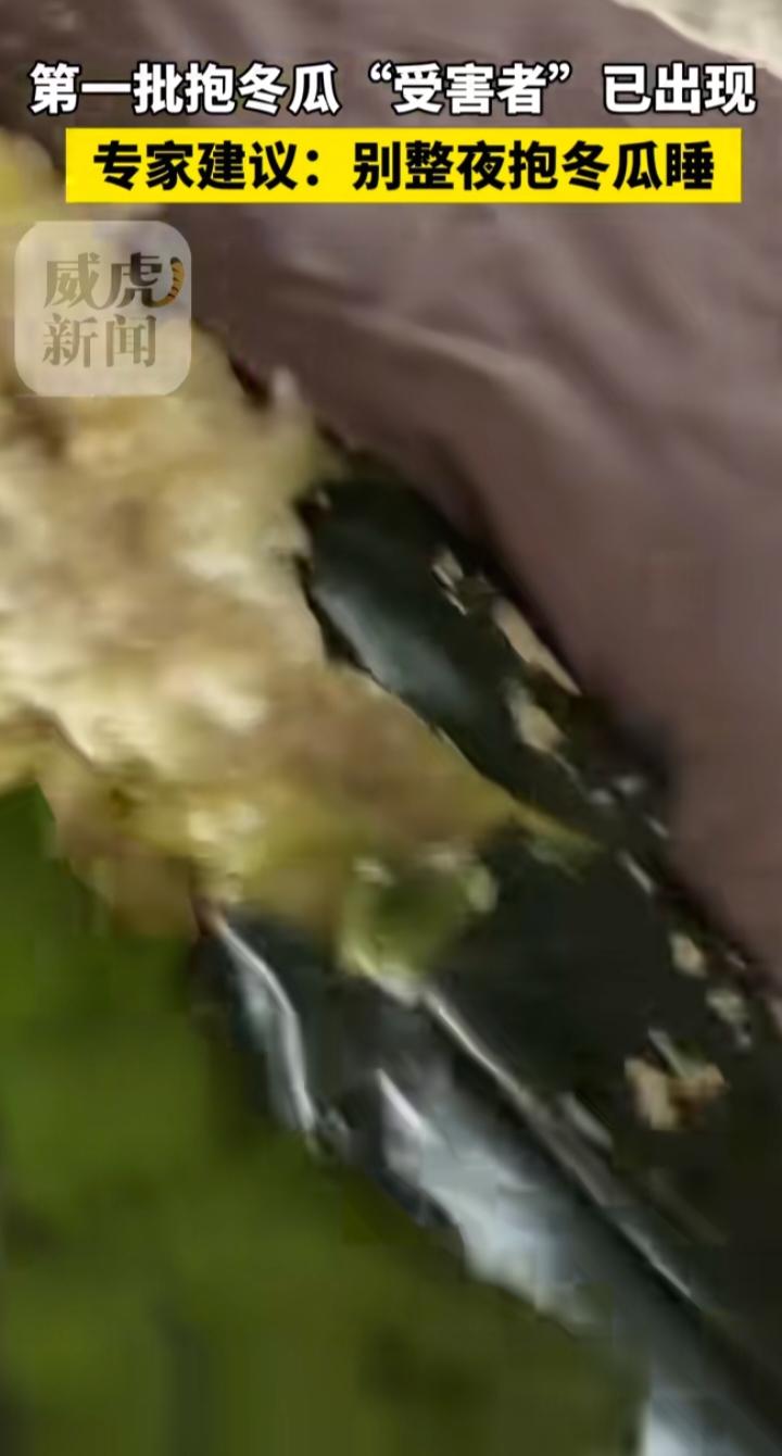网红“抱冬瓜睡觉”降温翻车！有人半夜炸瓜，专家紧急提醒
 
夏天想靠“天然凉枕”