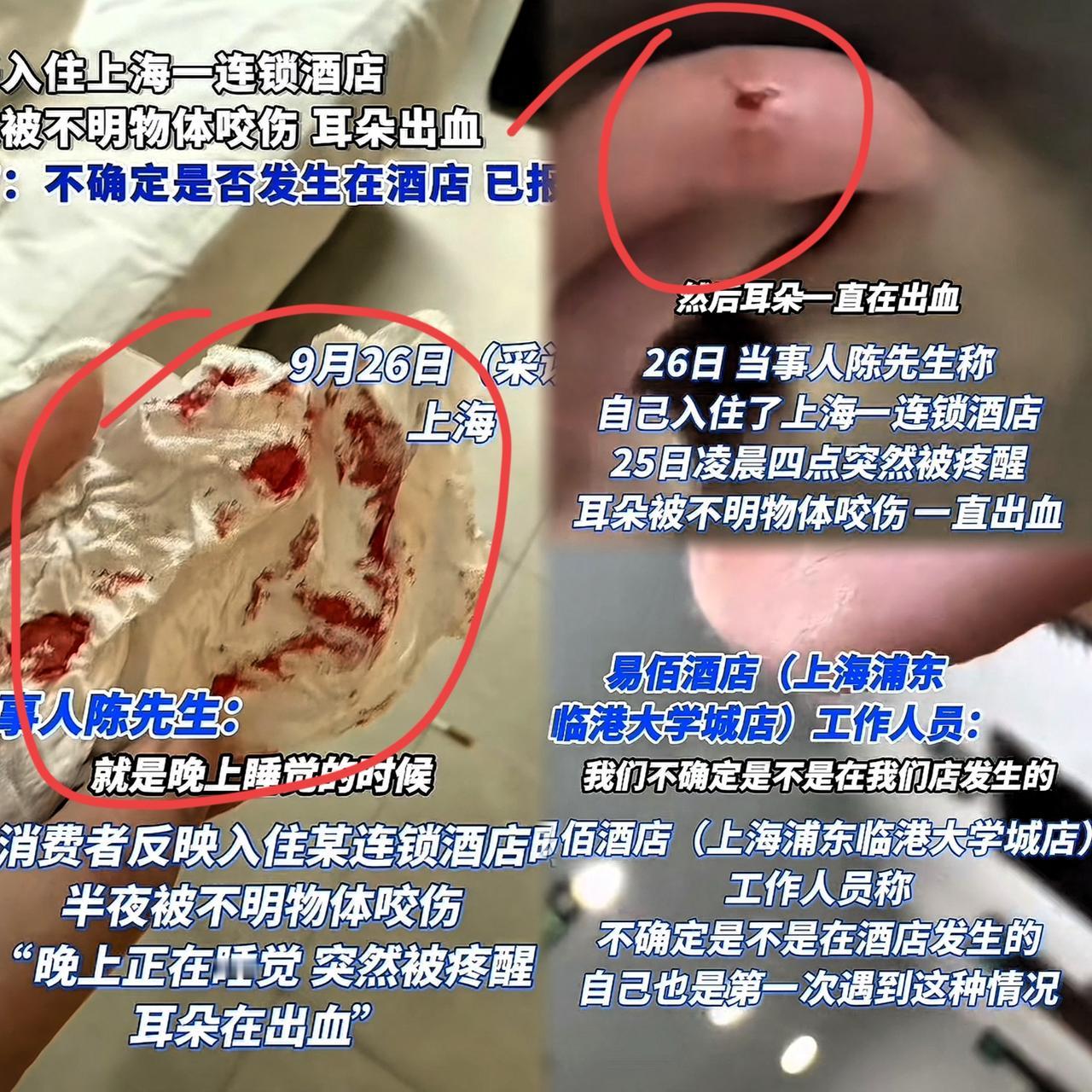 “倒大霉了！”上海一男子半夜在酒店休息时，突然感觉有东西在咬他耳朵，男子猛地张开