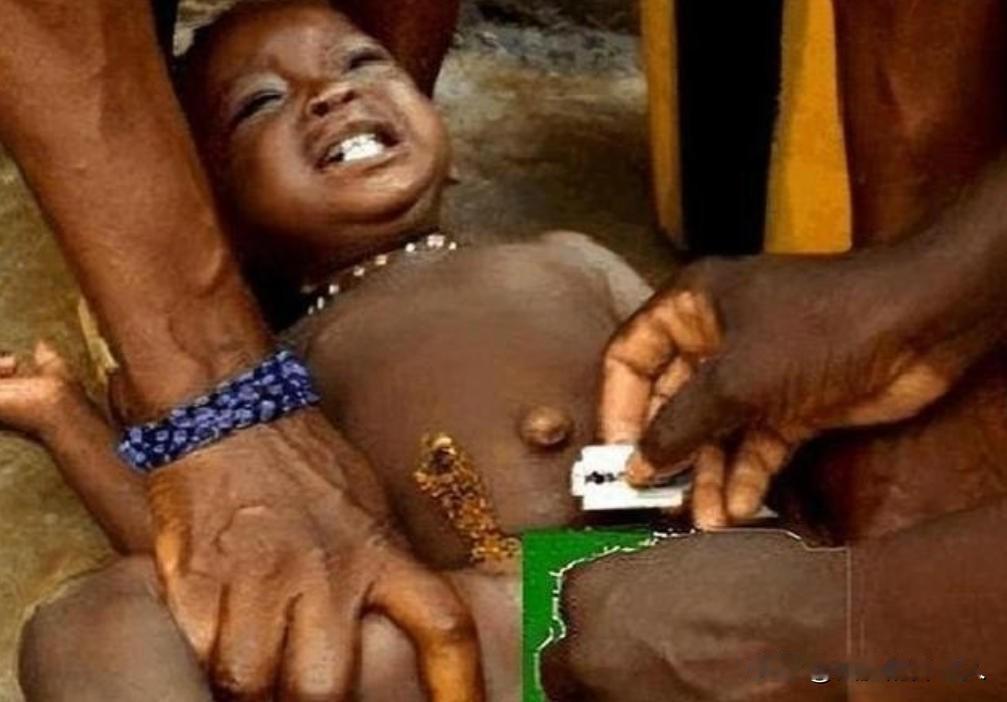 非洲有一项存在了3000多年的陋习。女孩5岁时，在没有麻醉的情况下，被女性长辈用