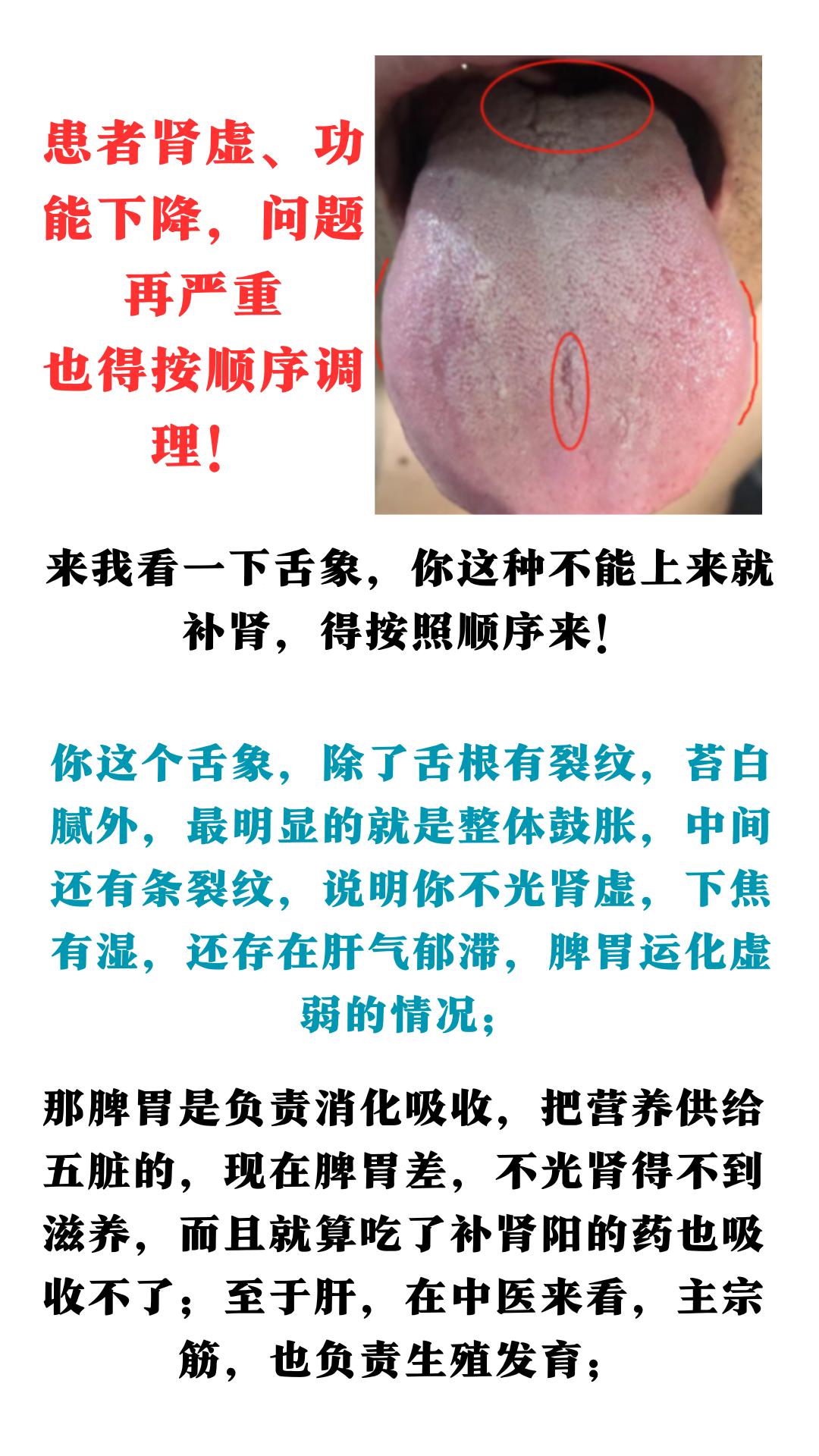 患者肾虚、功能下降，问题再严重，也得按顺序调理！#健康科普##中医##中药#