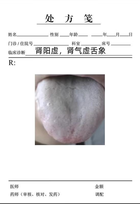 今天继续来给大家汇总分析粉丝朋友我们发来的舌像图。今天我们重点分享三个男科的。