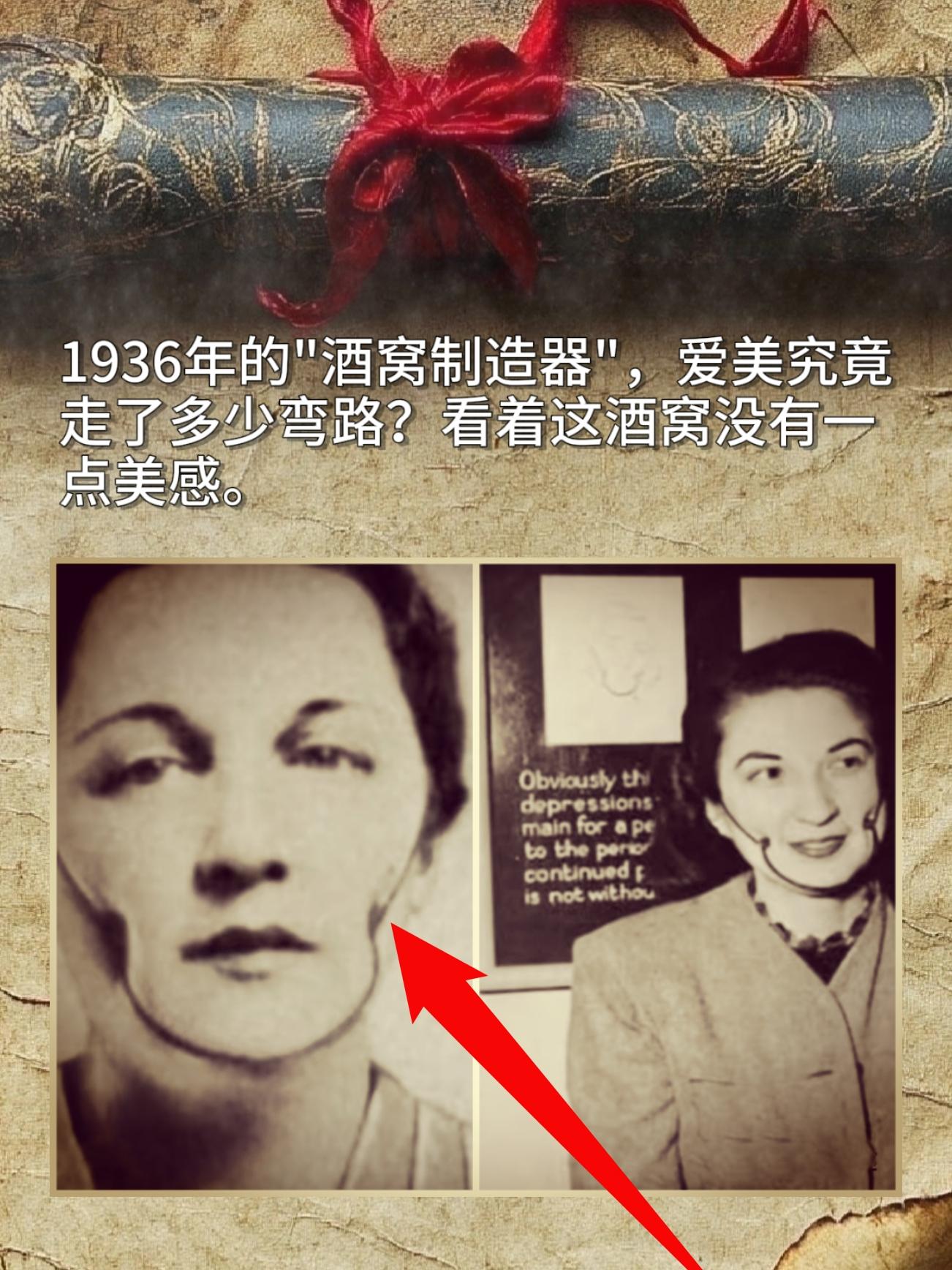 1936年的"酒窝制造器"，爱美究竟走了多少弯路？看着这酒窝没有点美感。