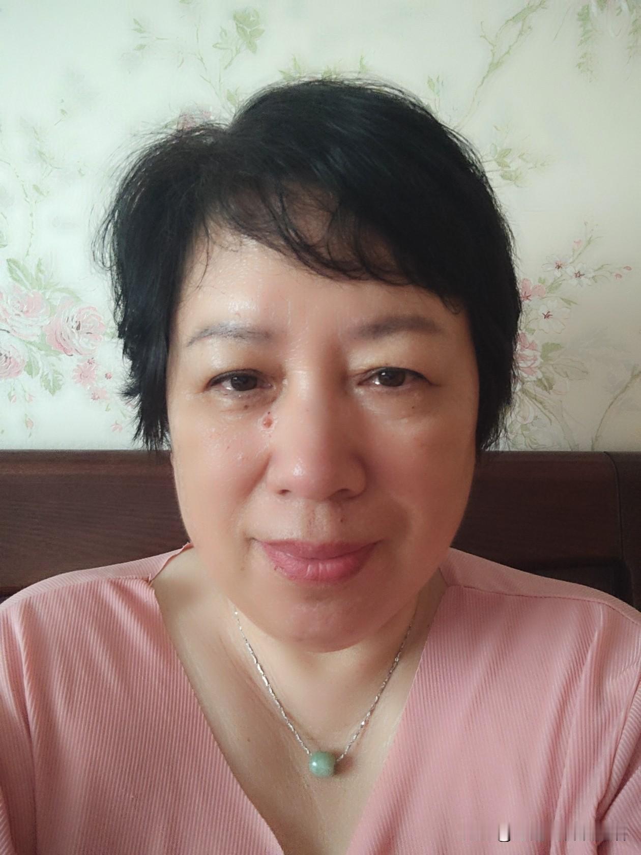 青岛大姐打小就是少白头，四年级头上就冒白丝，如今年纪大了，白发更是藏不住。前晚喊