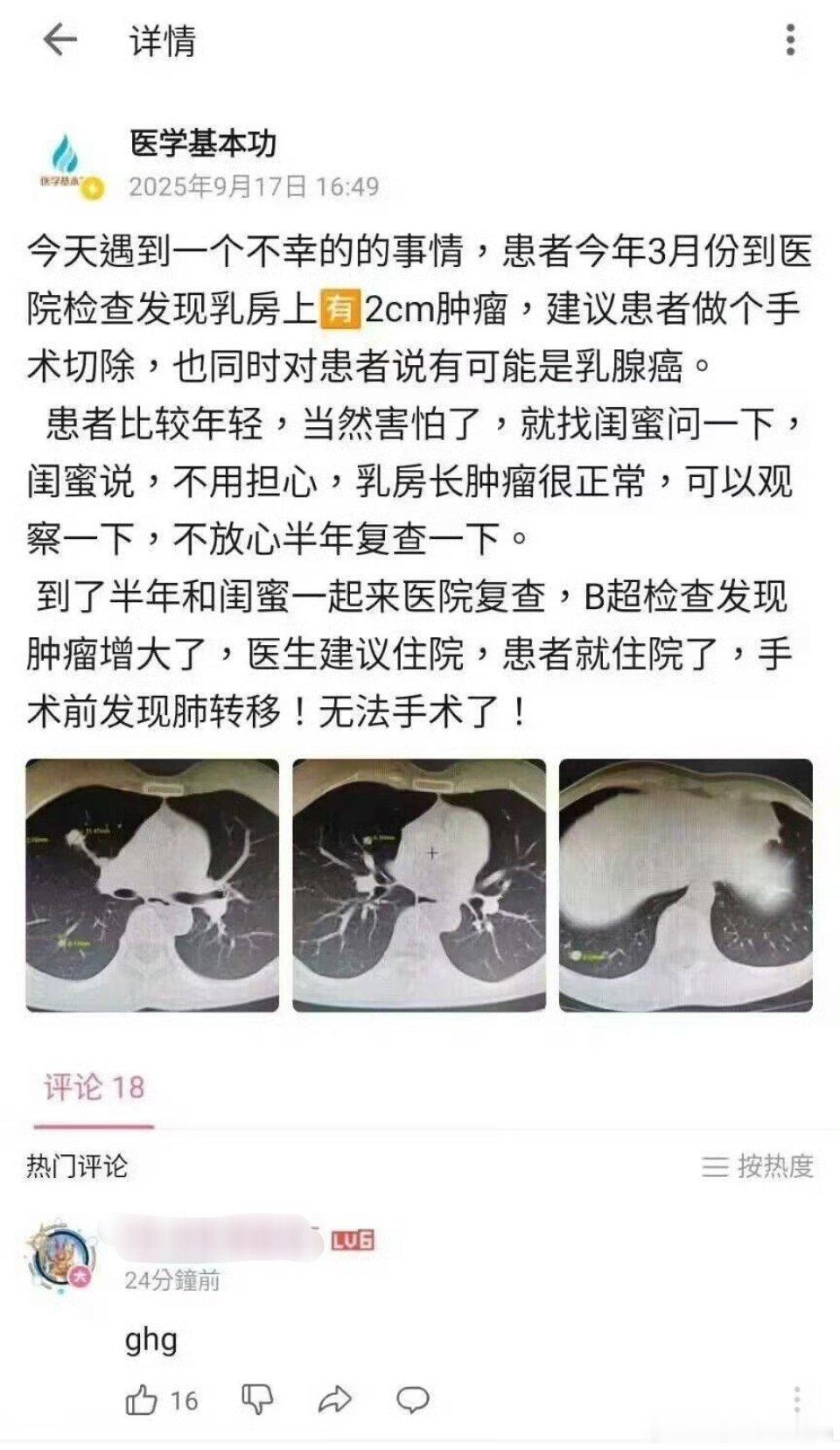 这不是闺蜜，是敌蜜 ​​​