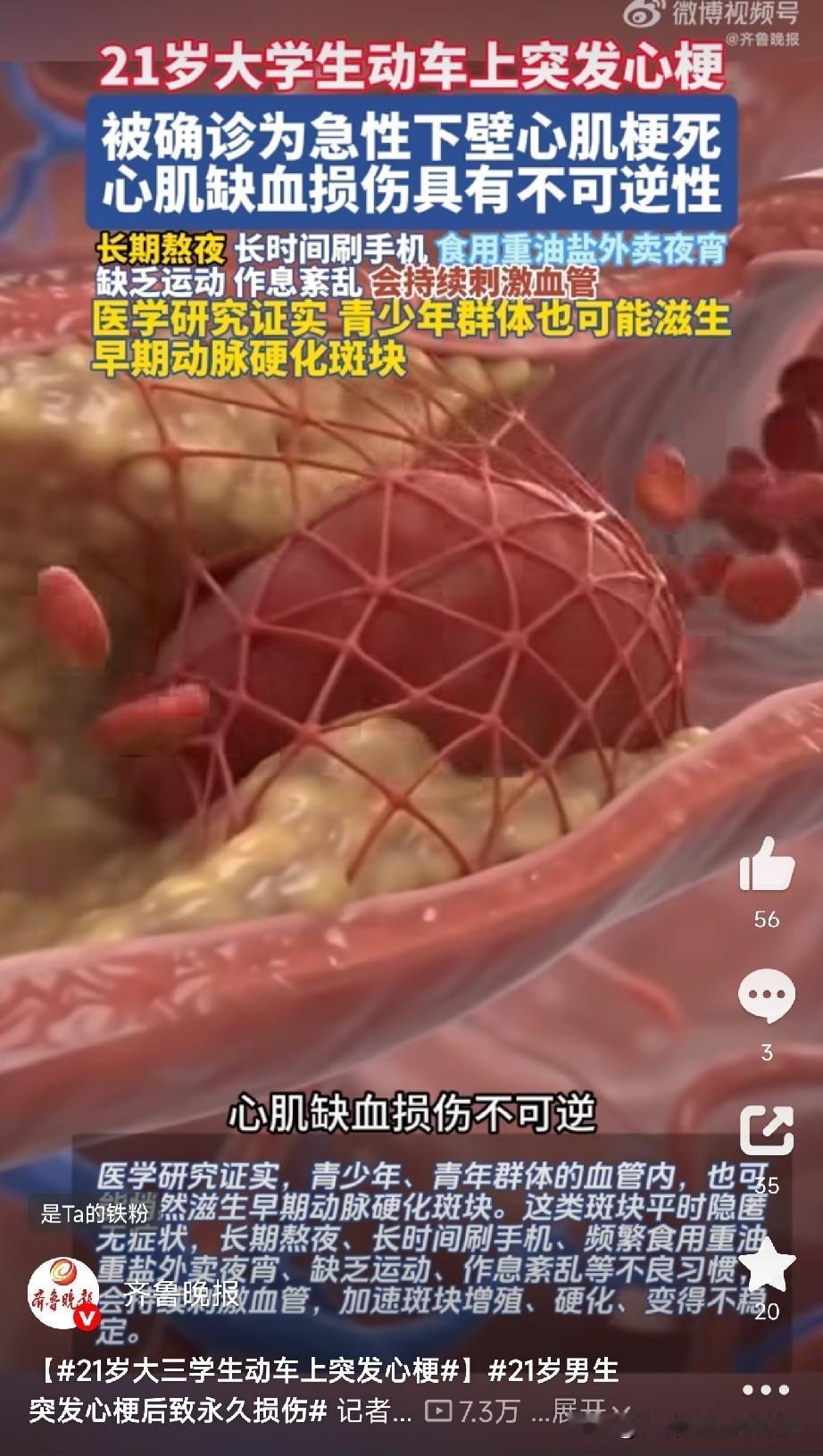 21岁大三学生动车上突发心梗！

近日，浙大二院接诊了一个21岁大三男生小李。动